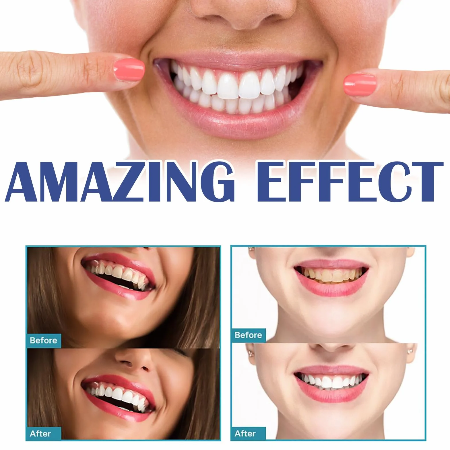 Penna siero riparatrice per gengive e denti, gel lenitivo rinforzante smalto, sbiancante denti rinfrescante alito (2pcs)