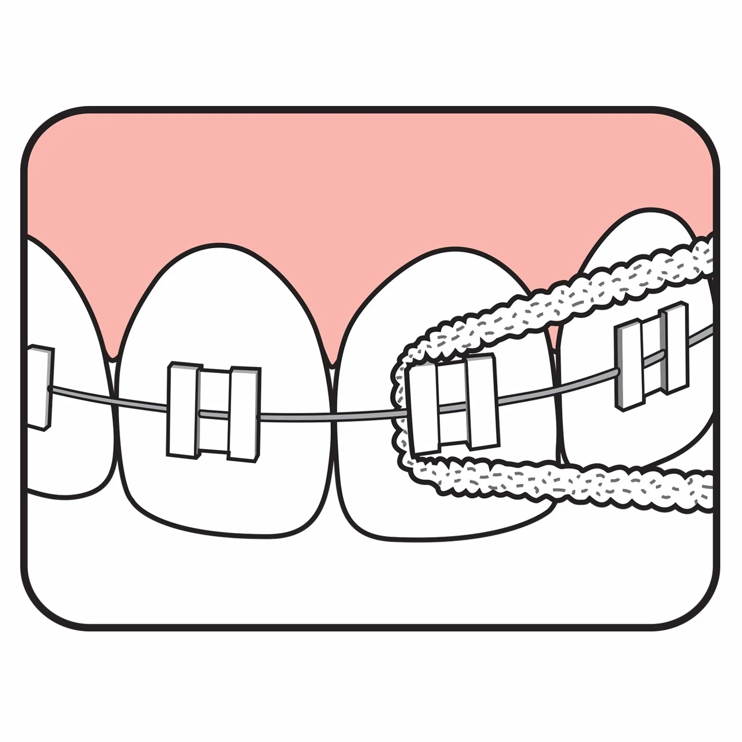 TePe Filo per ponti e impianti