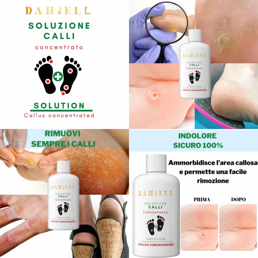 Callifugo Liquido Rimozione Calli Duroni Piedi Secchi Screpolati Dahbell