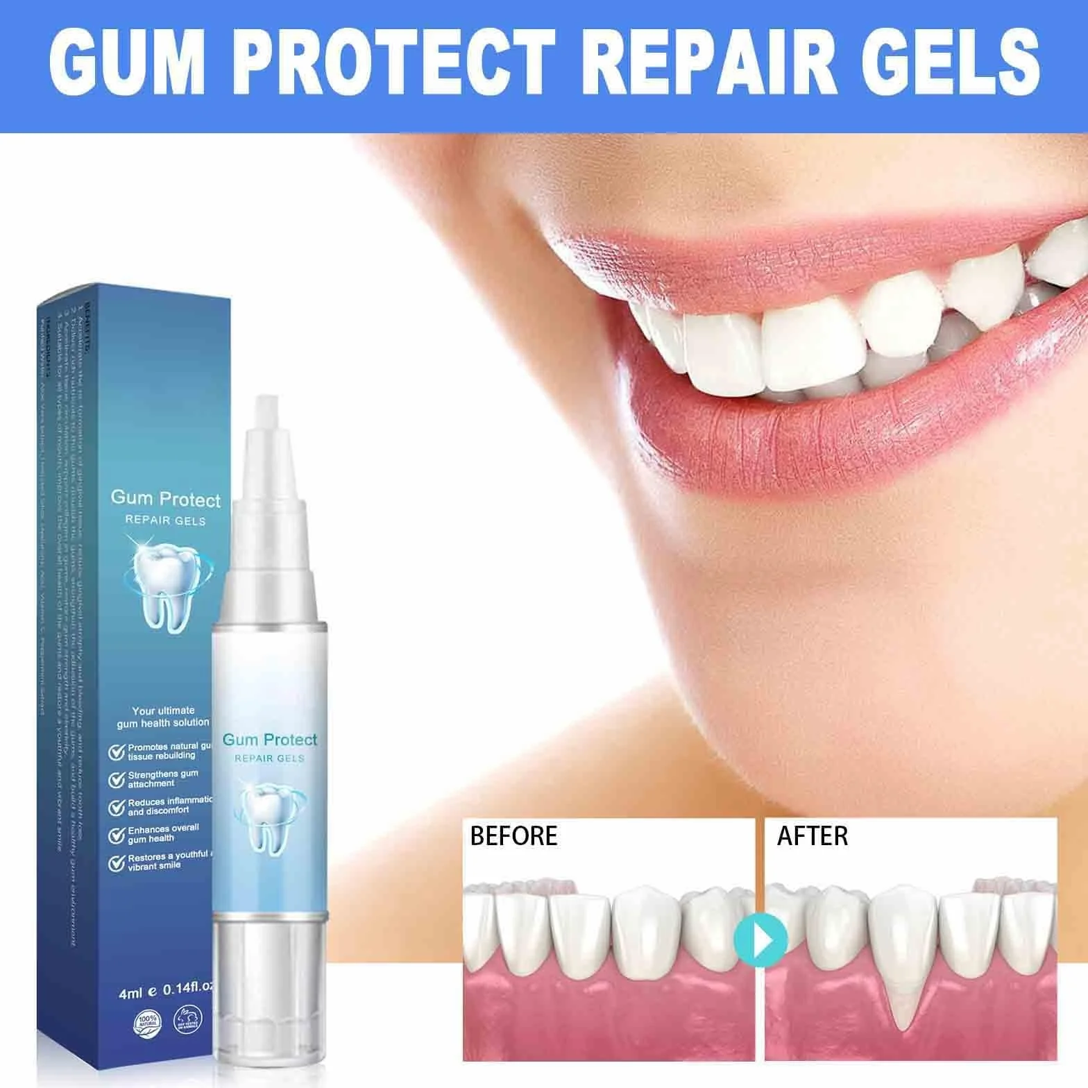 Gel Terapia Gengivale Gum Shield Therapy, Sbiancamento Denti, Riparazione Gengive e Protezione (5)