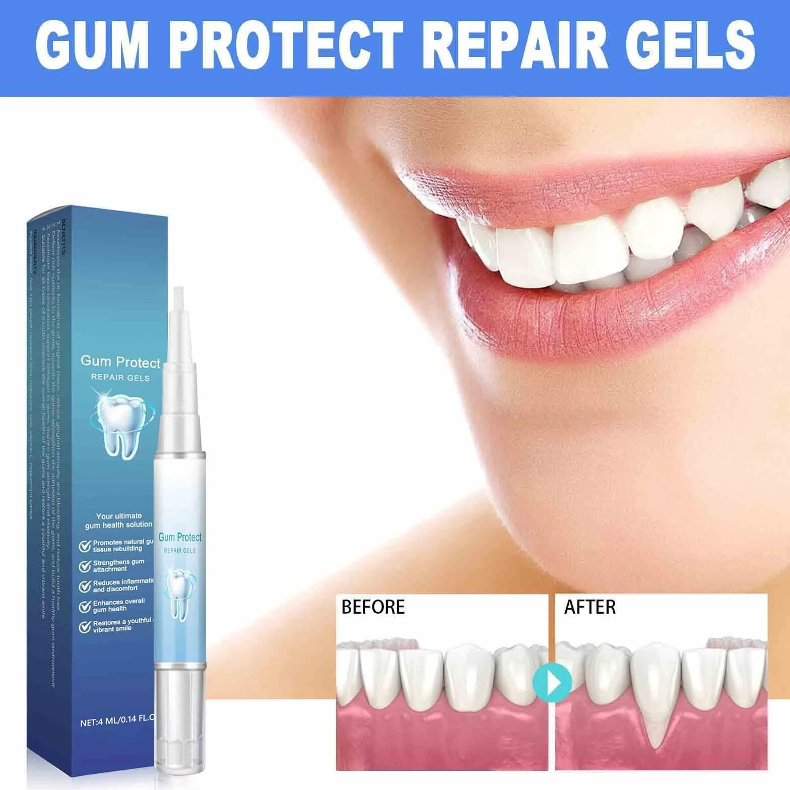 Gum Protect Repair Gel per Terapia Gengivale – Teeth Repair Gel per Riparazione Gengive (5)