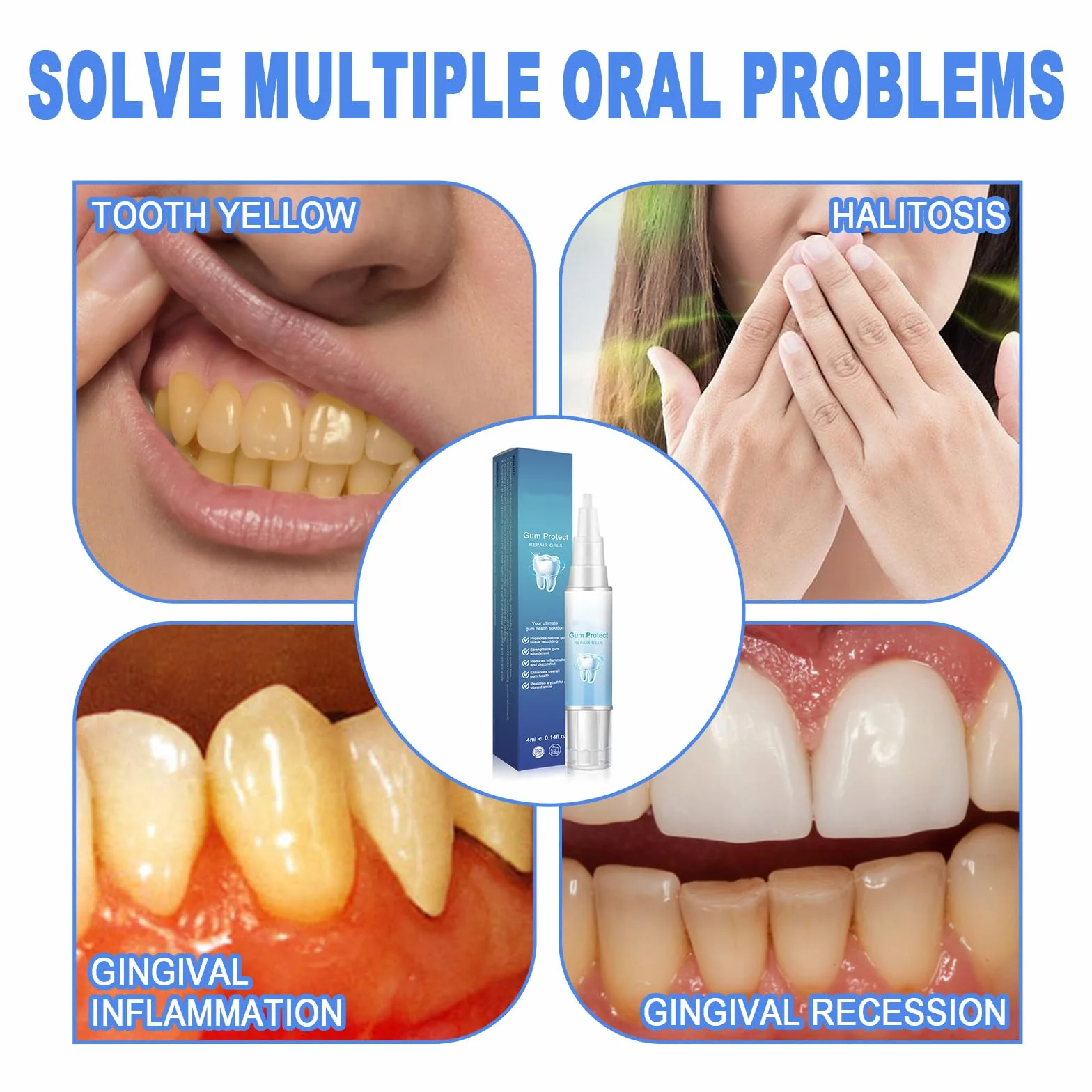 Gum Shield Therapy Gel protezione gengive - Gel terapeutico per gengive, Repain Protect e Gocce Repeller