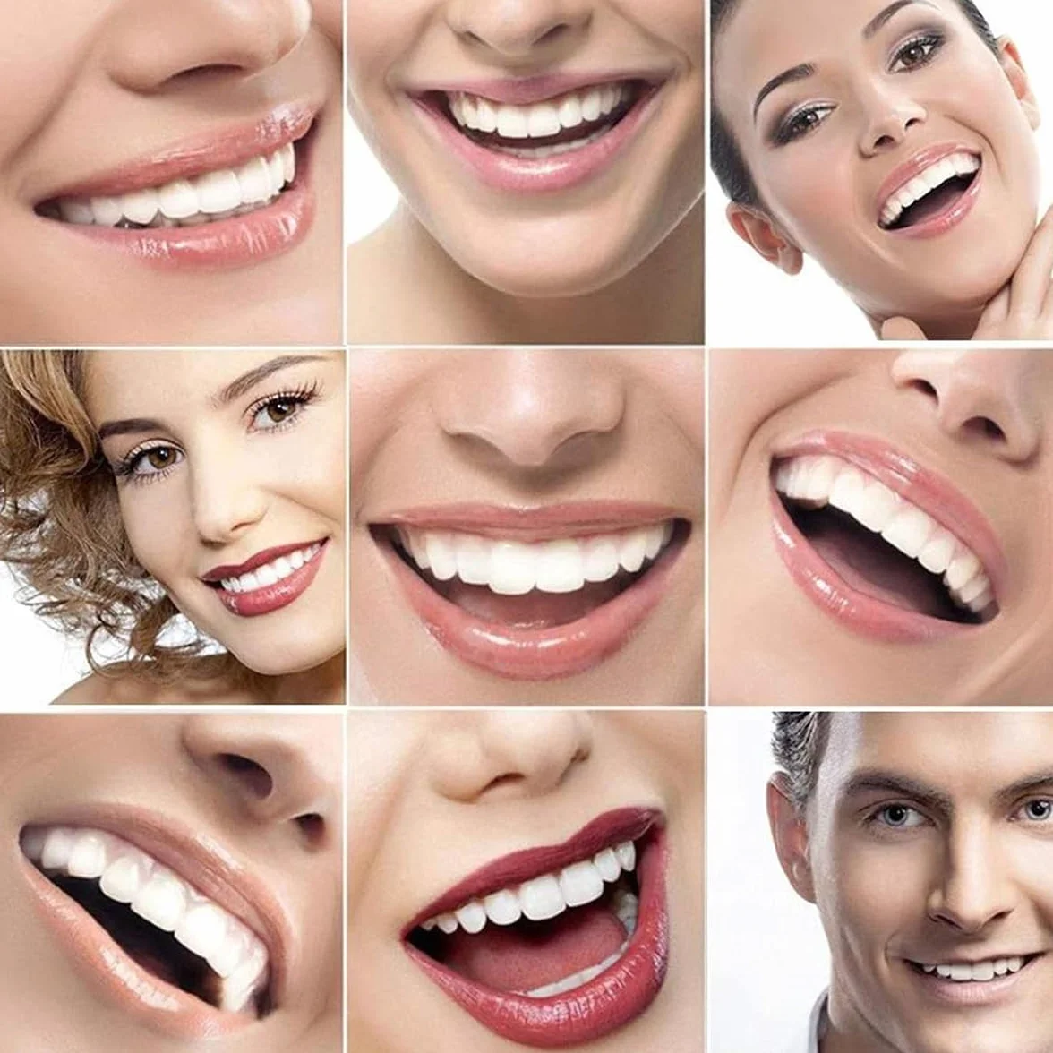 Denti Finti Temporanei Clip Superiore e Inferiore, Protesi Cosmetica in Silicone per Coprire Denti Mancanti