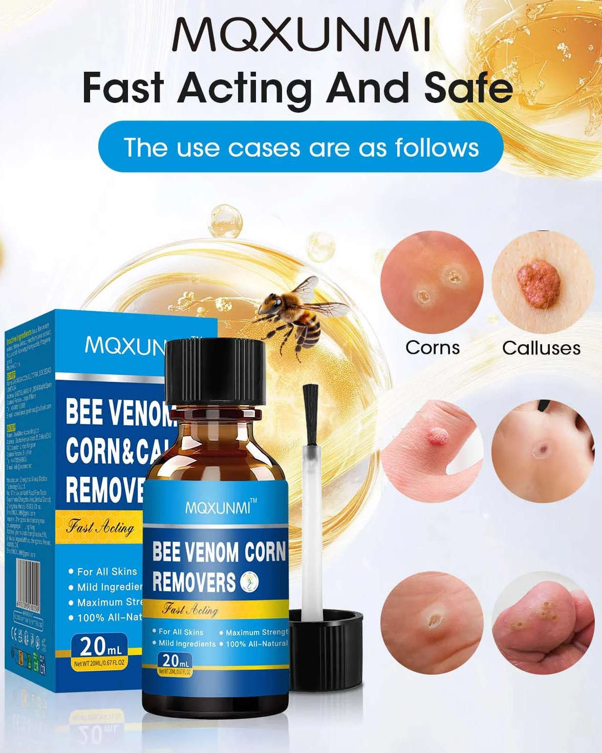 Bee Venom Callus Remover 20 ml - Rapid Action Liquid for Feet, Adults, Runners