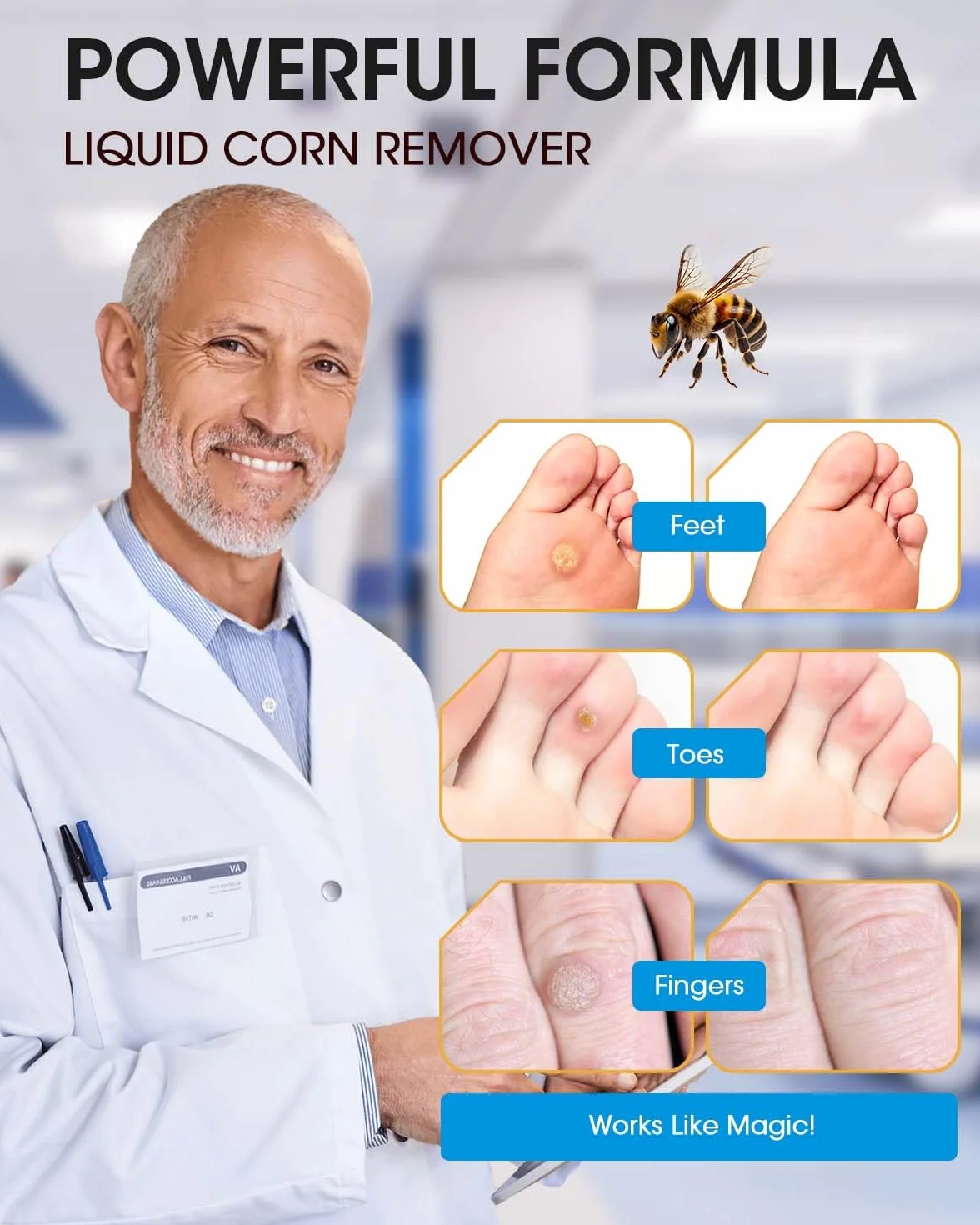 Bee Venom Callus Remover 20 ml - Rapid Action Liquid for Feet, Adults, Runners