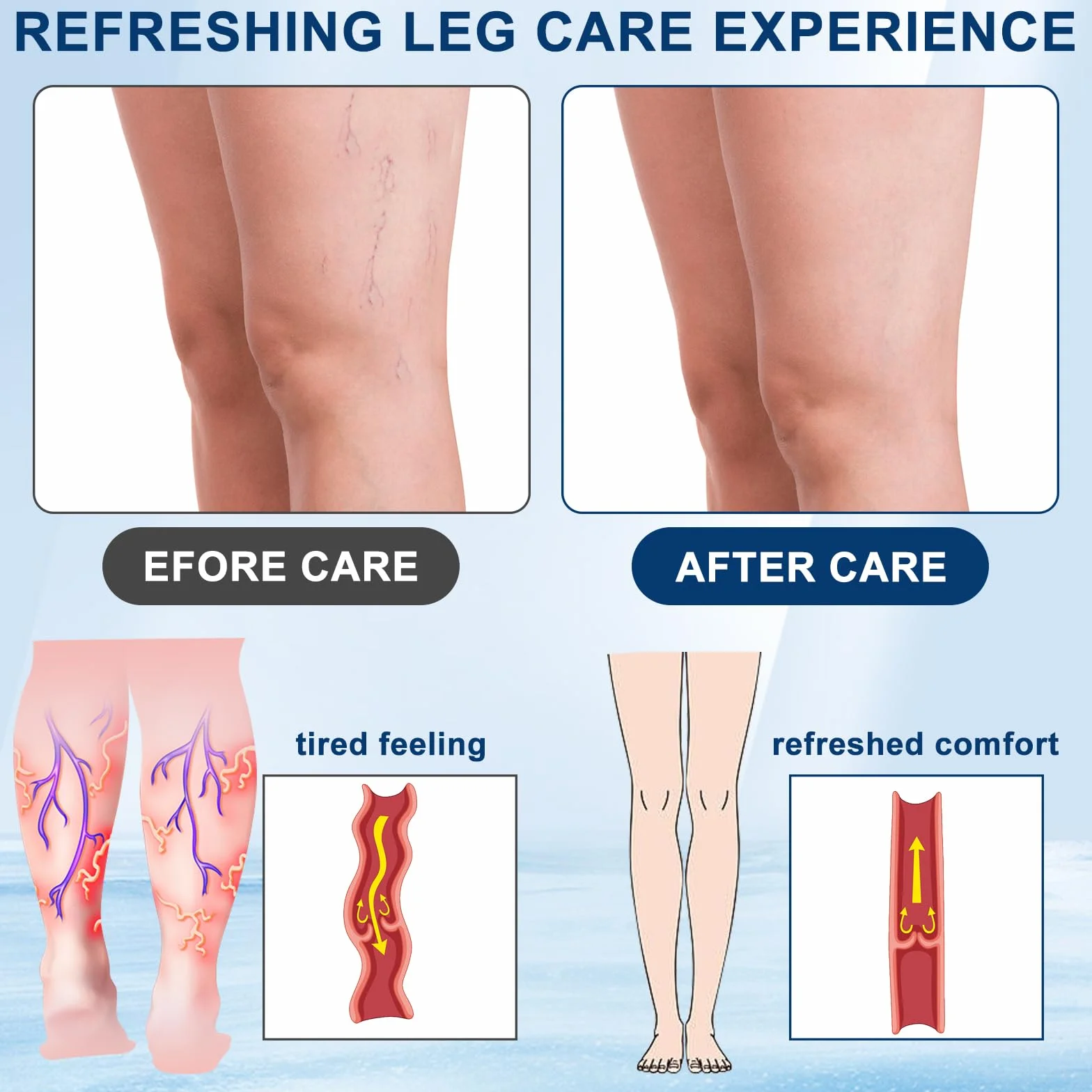 Cerotti per Gambe Stanche 8 Pezzi, Patch a Micro-aghi per Cura e Comfort delle Gambe