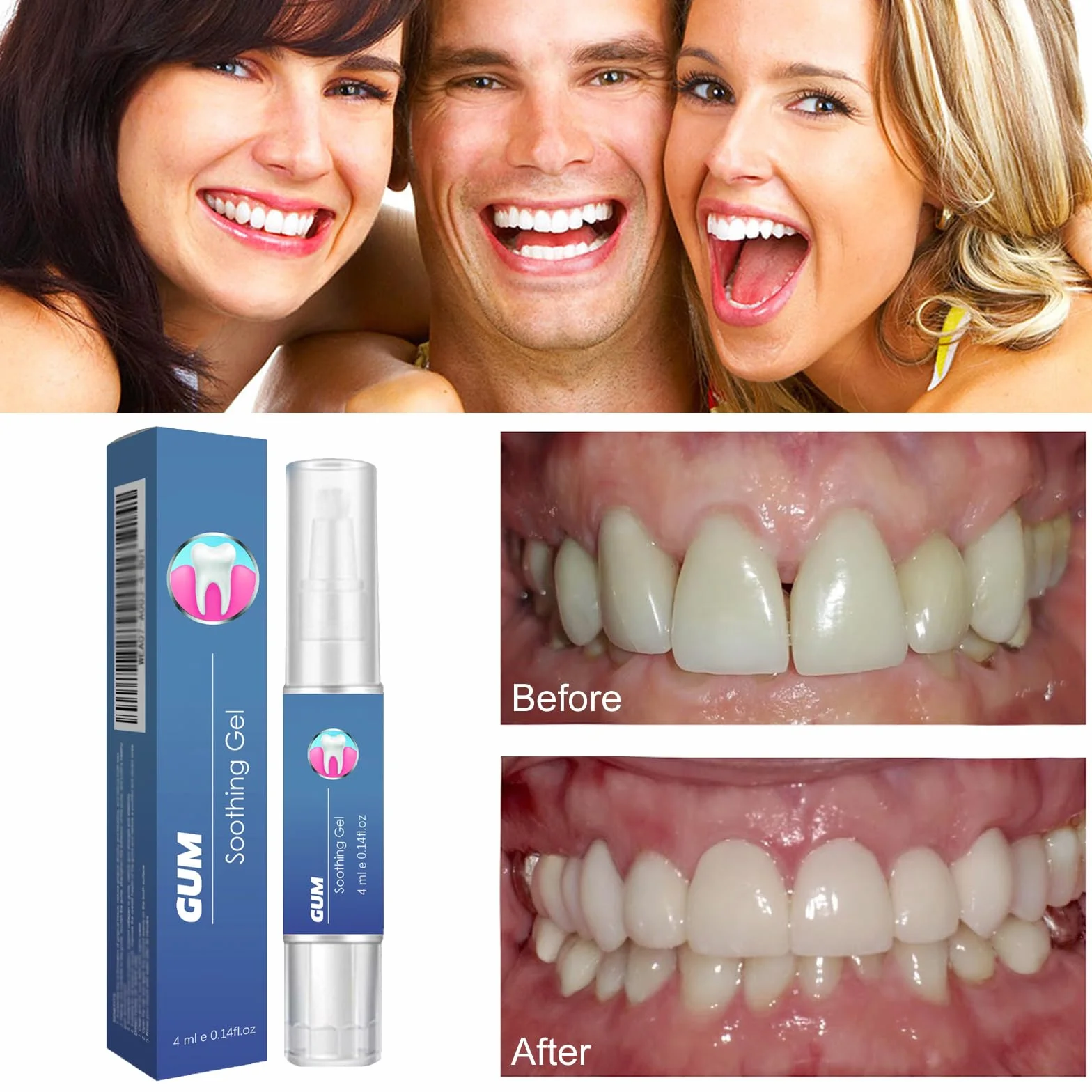 Penna siero riparatrice per gengive e denti, gel lenitivo rinforzante smalto, sbiancante denti rinfrescante alito (2pcs)