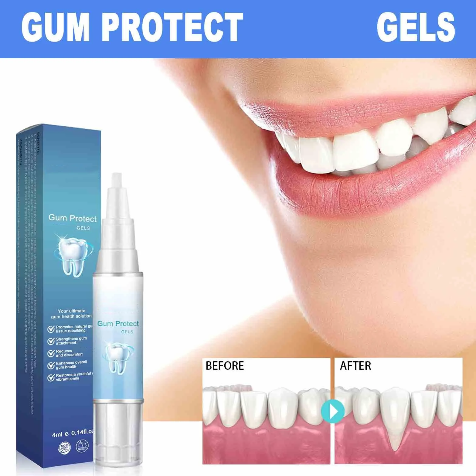 Gel Teeth Whitening Essence Pen, Gum Instant Treatment 4ml
