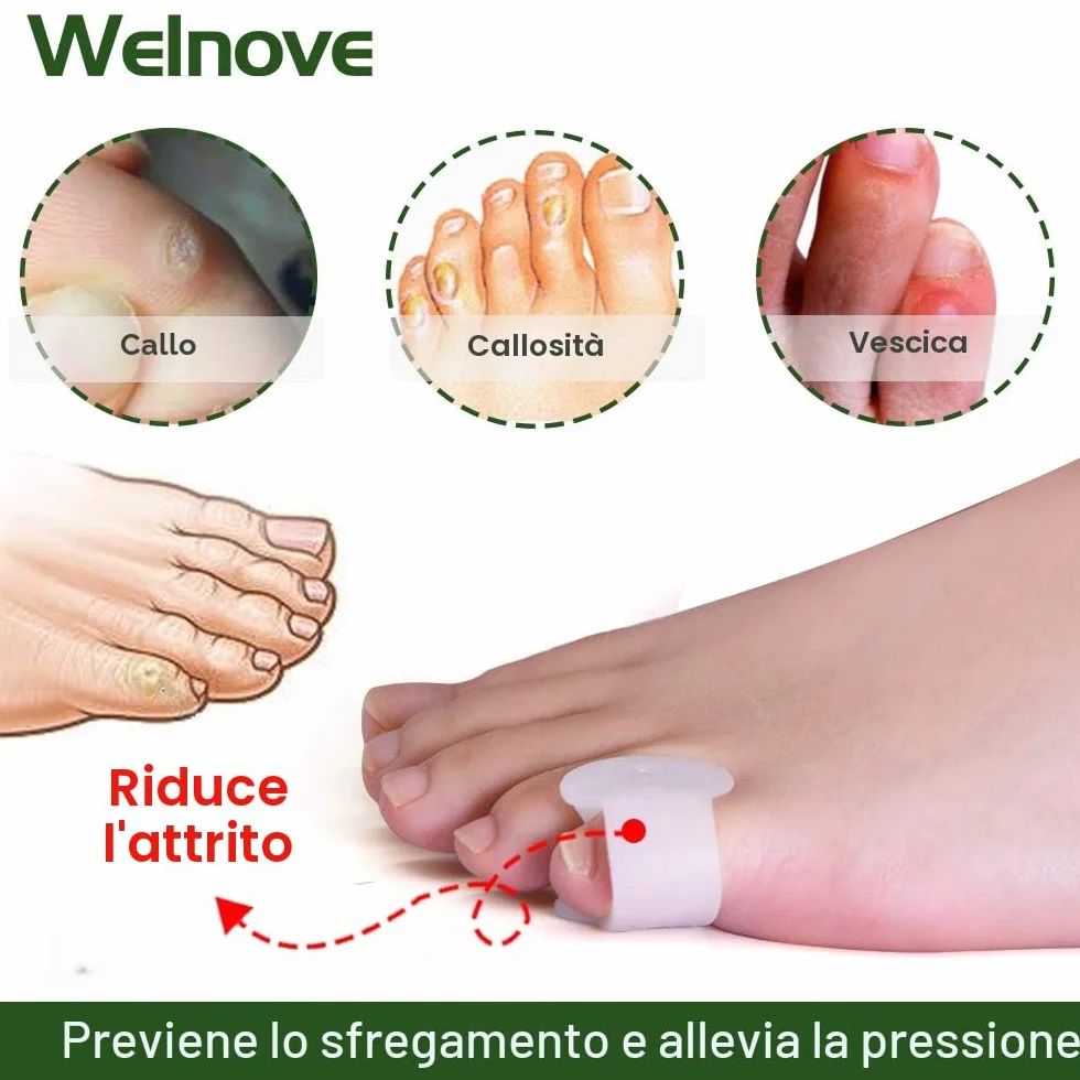 Separatore Dita Piedi Silicone Alluce Valgo 12 Pezzi - Welnove