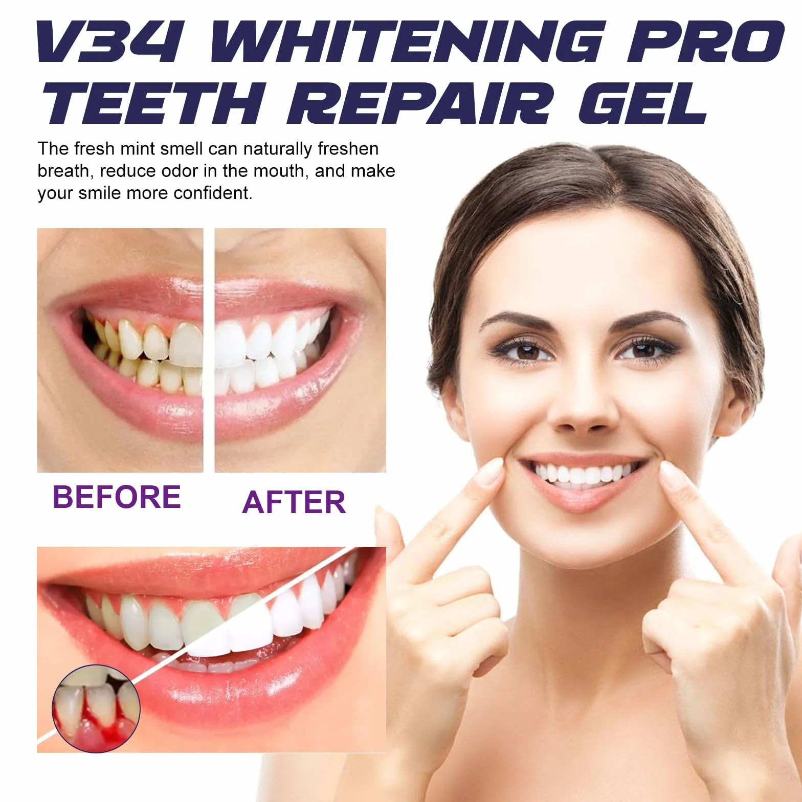 Gel Trattamento delle Gengive, Sbiancante Dentale, Recessione Gengivale
