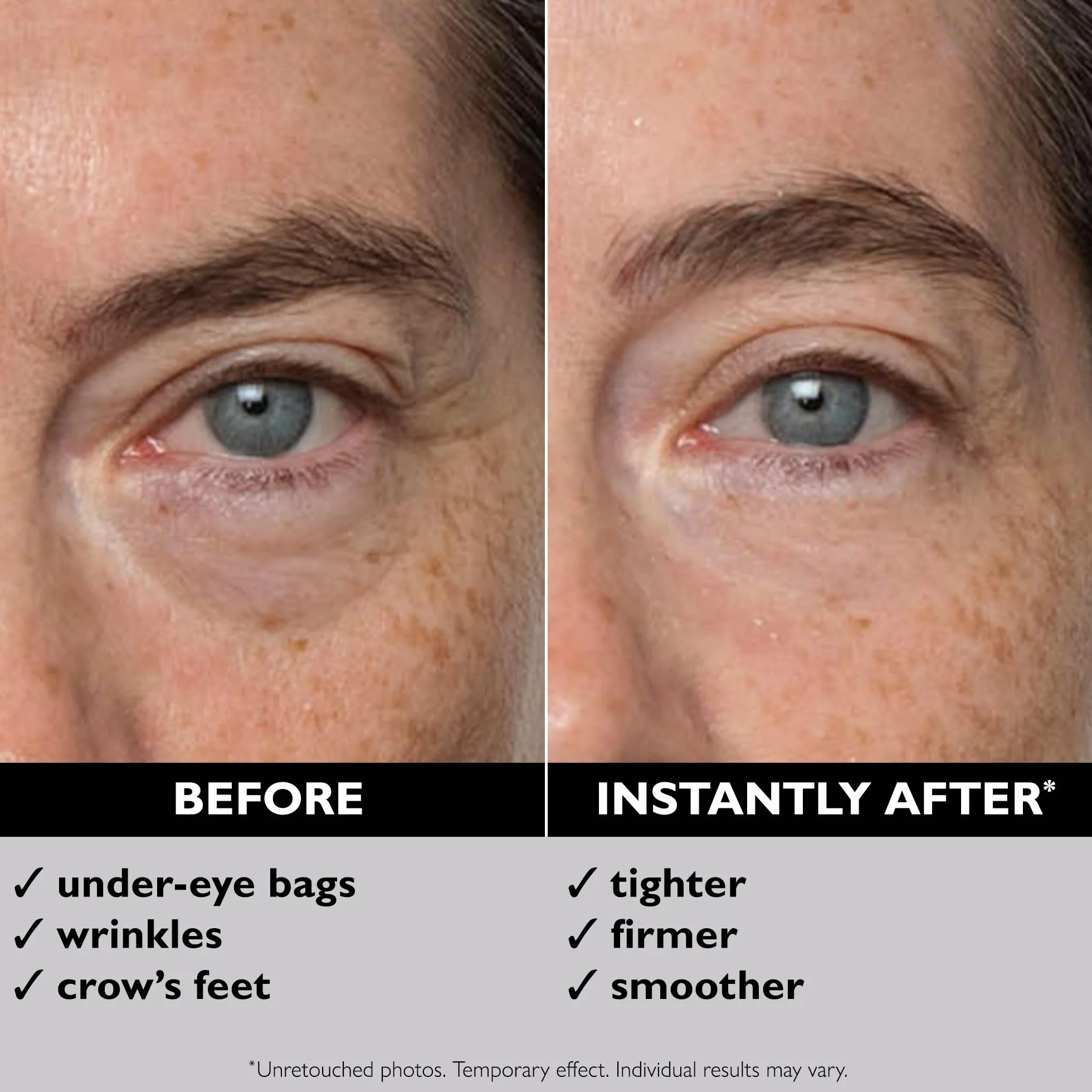 Peter Thomas Roth Instant FIRMx Eye Temporary Eye Tightener 30ml Gel Contorno Occhi Lifting Istantaneo