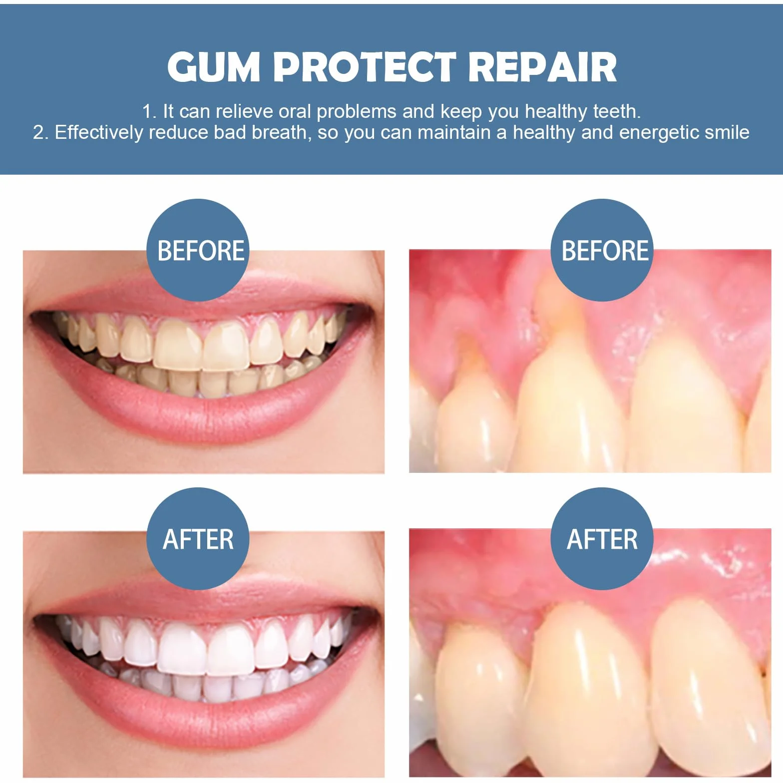 Dentizen Gel Terapia Gengivale Riparazione Gomma Penna Sbiancante