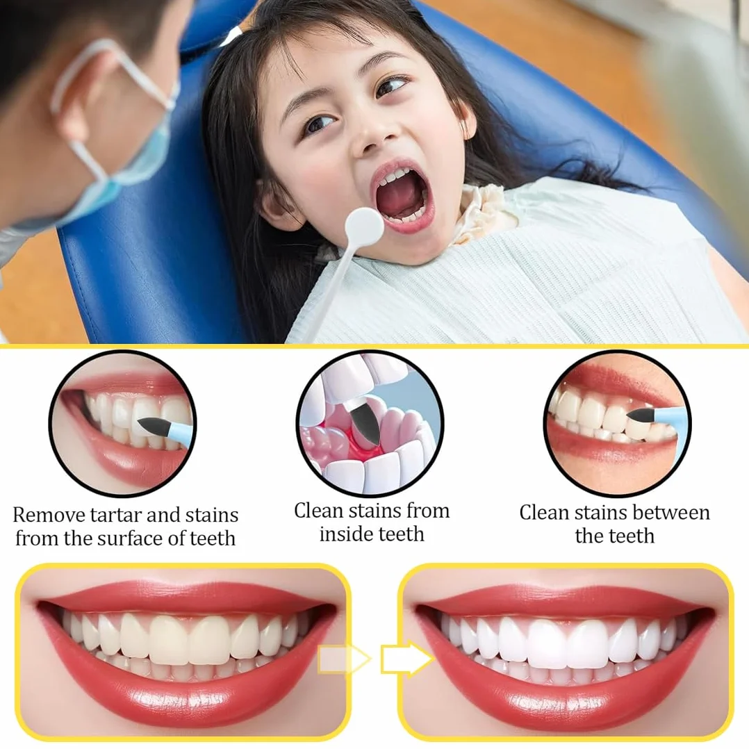 Kit Pulizia Denti Rimozione Tartaro Sbiancante Denti (2 Rimuovi Tartaro, 1 Gancio, 1 Specchio)