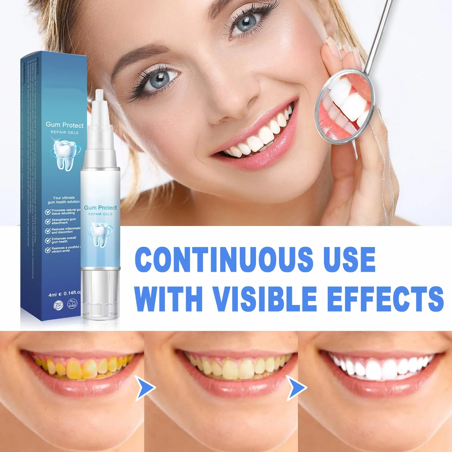 Gum Shield Therapy Gel protezione gengive - Gel terapeutico per gengive, Repain Protect e Gocce Repeller