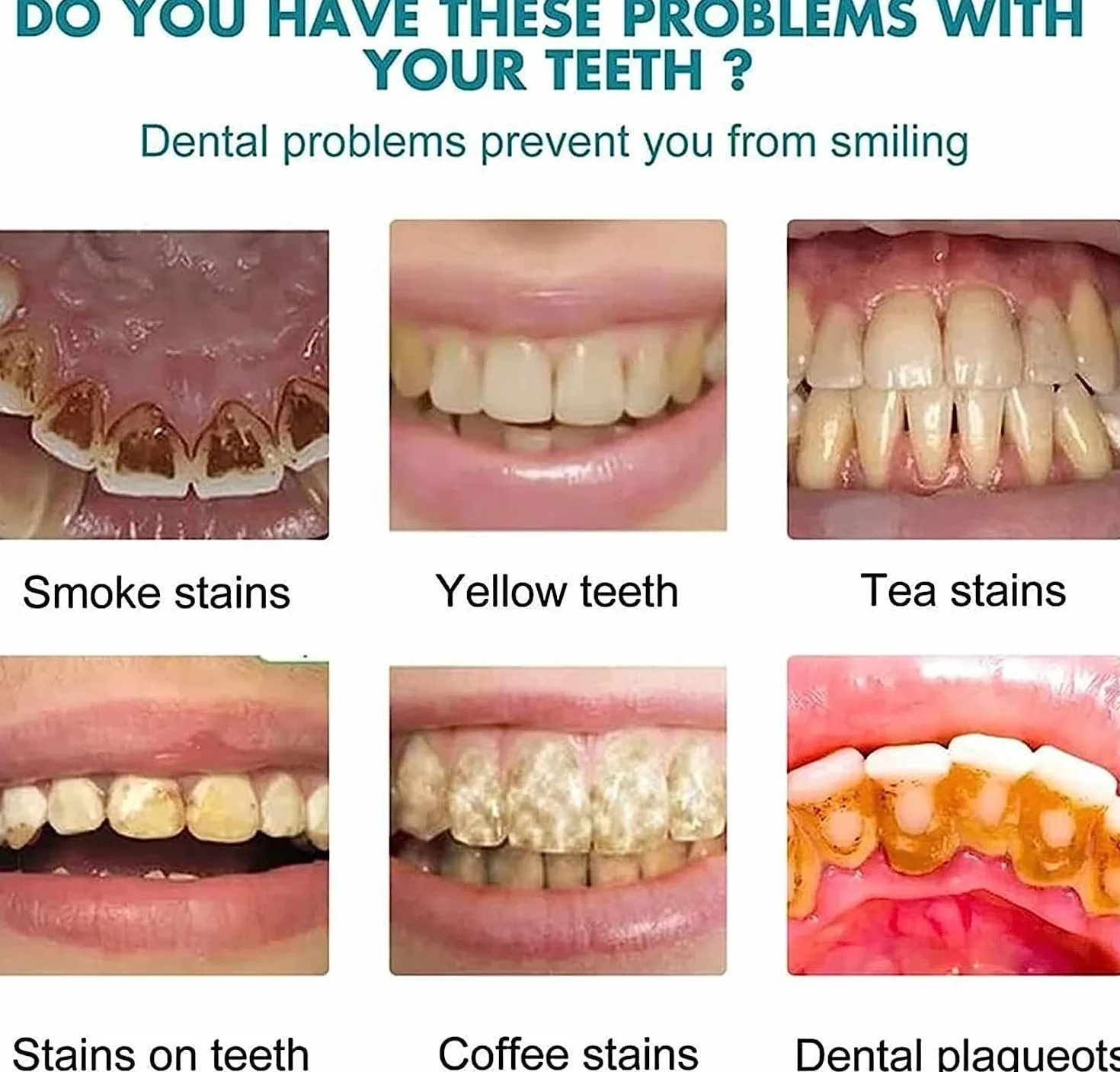 Teeth Whitening Paint, Instant Whitening Tooth Paint (1pcs)