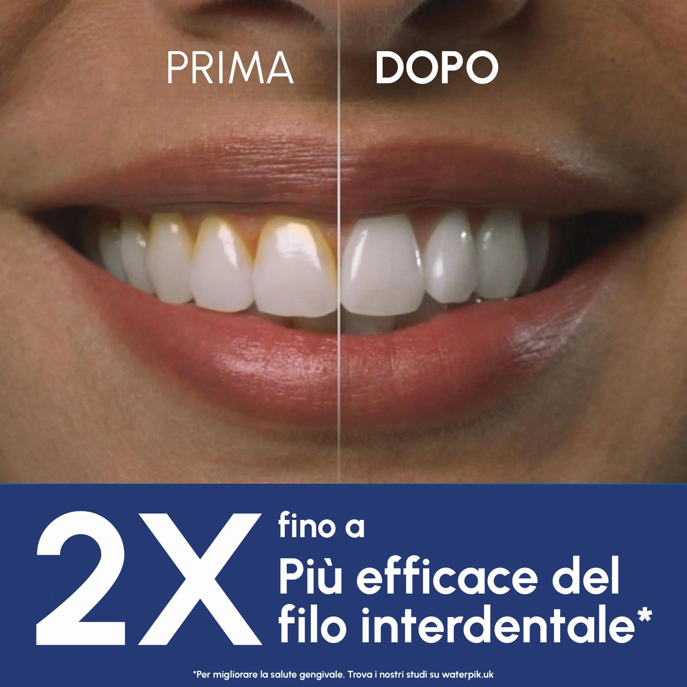 Waterpik Idropulsore Dentale Ultra Professional WP-662EU, 6 Testine, 10 Impostazioni, Nero