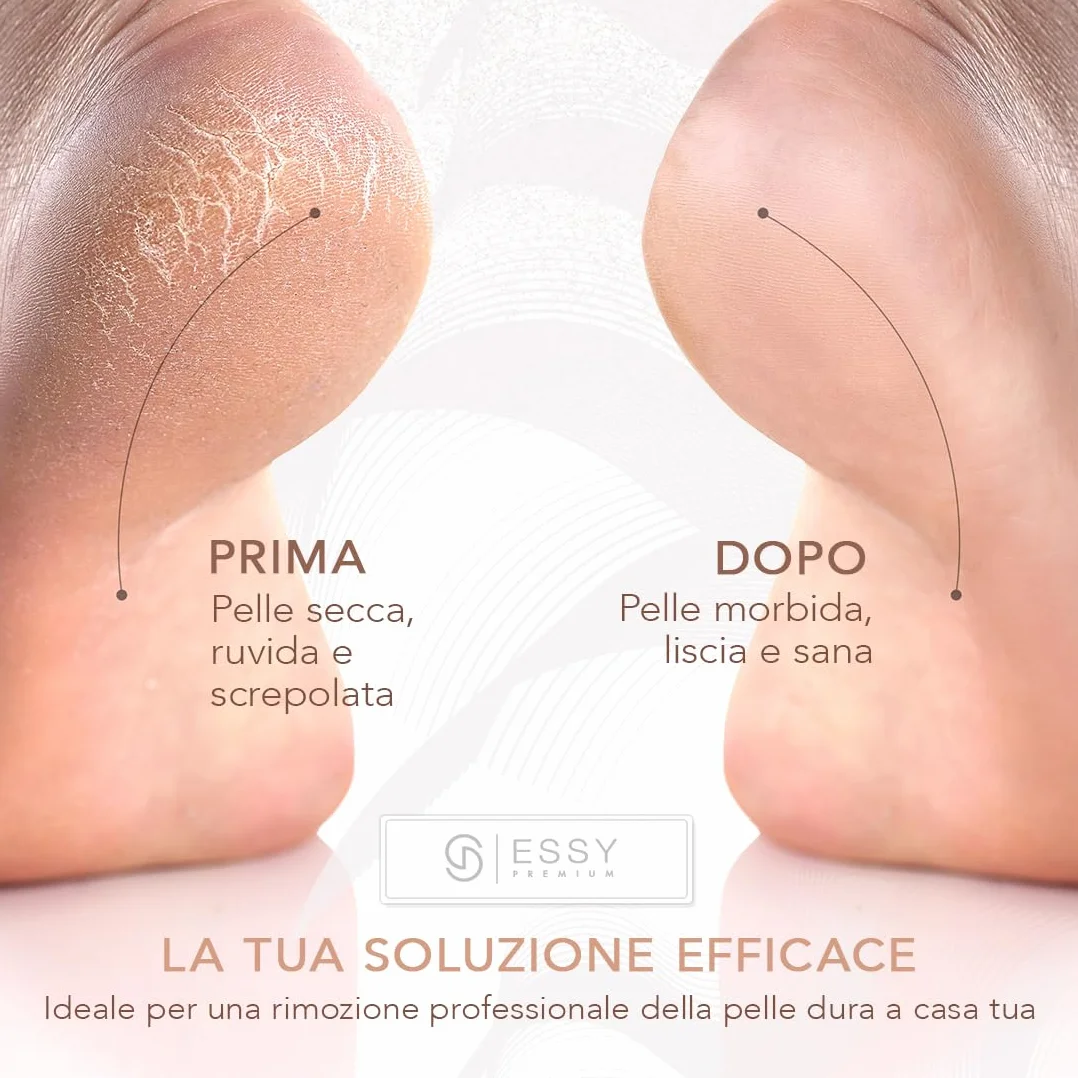 Essy Rulli Ricariche Per Piedi Set Di 5 – Trame Fine, Media e Grossolana – Rimozione Pelle Dura Esfoliazione Cura Dei Piedi (Bianco)