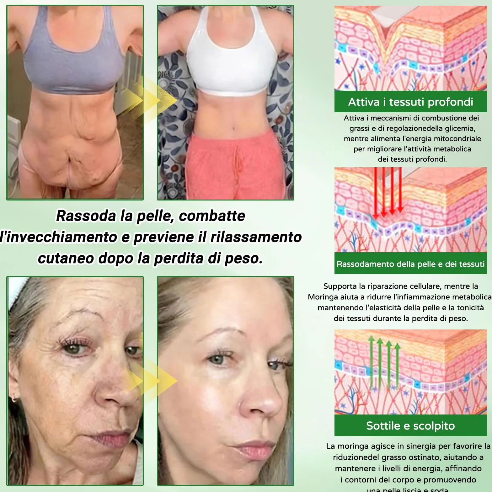 Morina NAD+ Cerotto Micronedle Avanzato 12-IN-1 Naturali Moringa Cerotti Dimagranti per Addome Braccia Gambe (2 Scatole)
