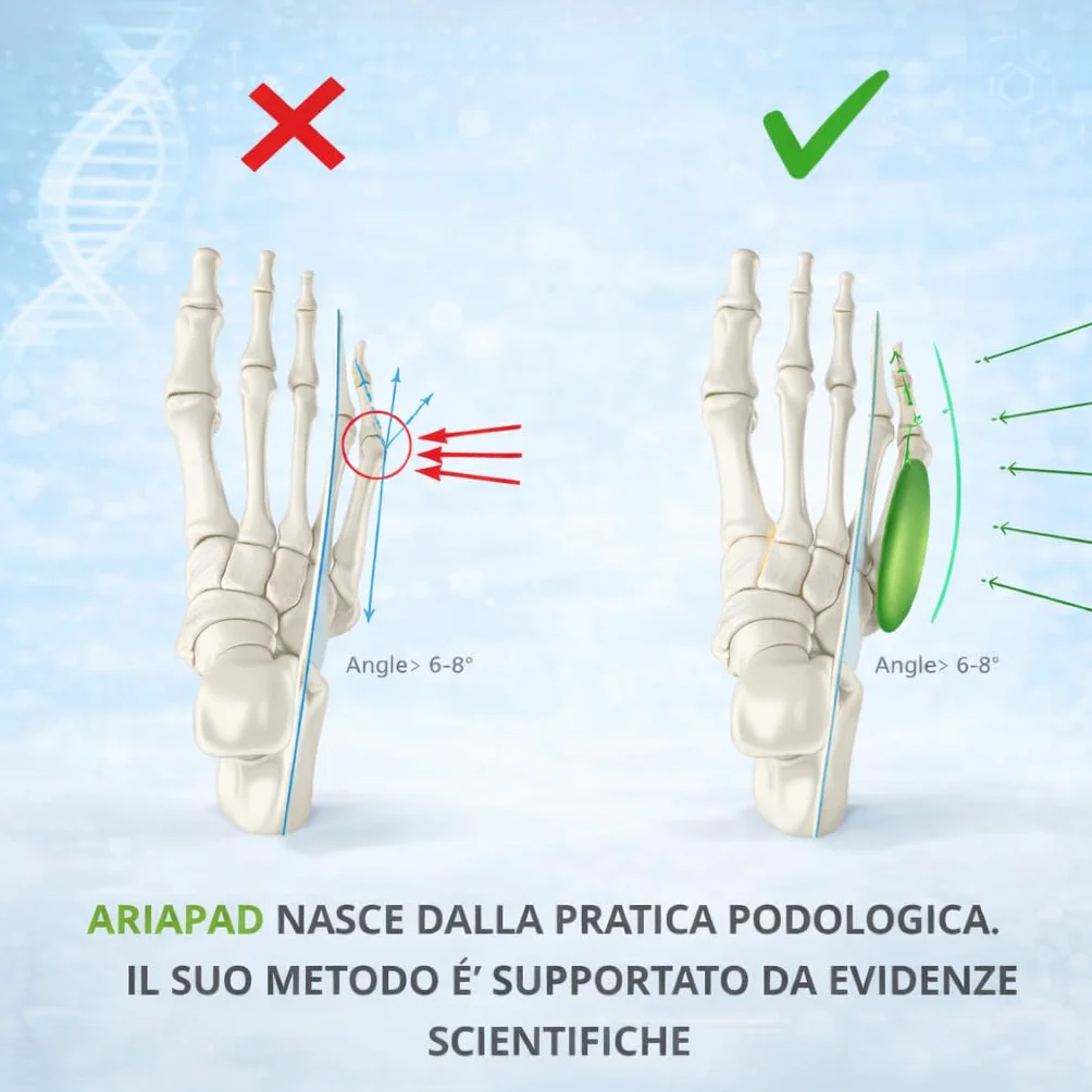Tutore Podologico Mignolo Varo per Quinto Metatarso Bunionette – Dispositivo Medico CE (1 pz)
