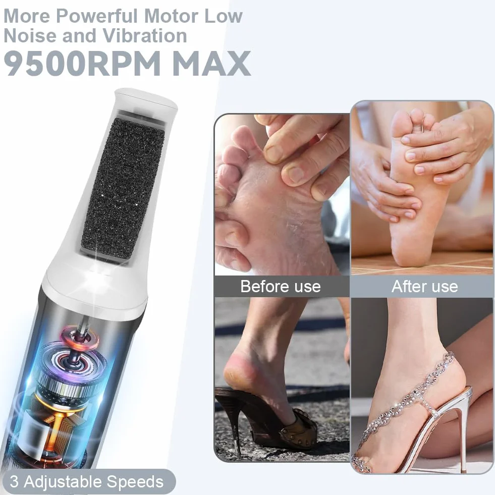 AOOWU Pedicure Elettrico Professionale 17 Pezzi Kit Rimozione Calli con 3 Rulli 3 Velocità Impermeabile LED