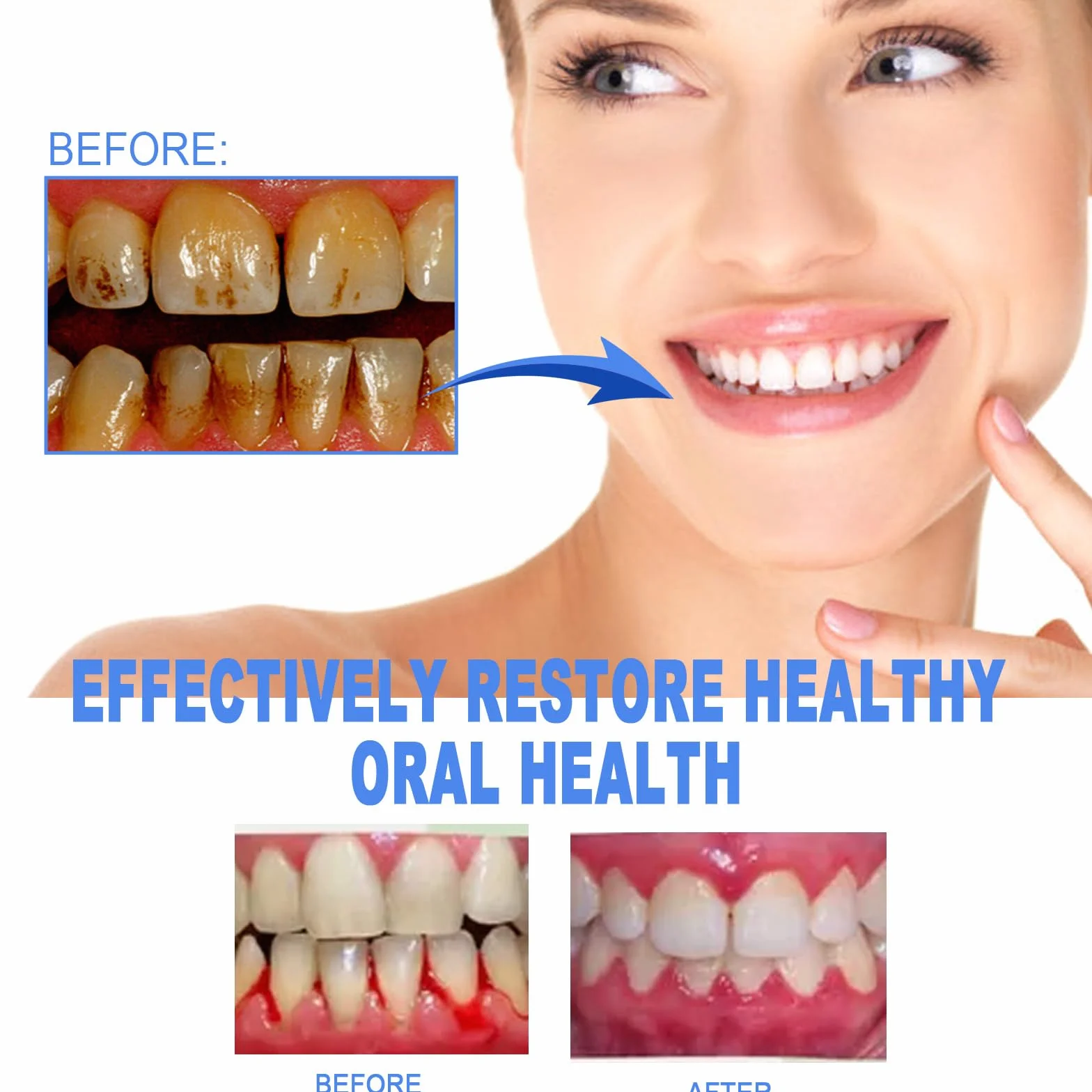 Gum Shield Therapy Gel protezione gengive - Gel terapeutico per gengive, Repain Protect e Gocce Repeller