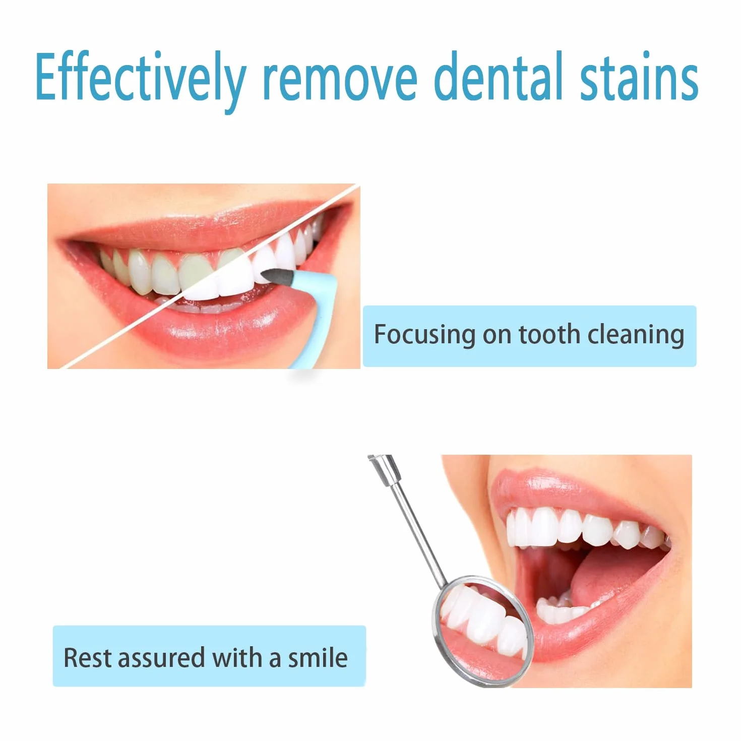 Smacchiatore Denti Professionale 3 Pezzi Rimozione Tartaro Sbiancante Denti per Apparecchi Ortodontici