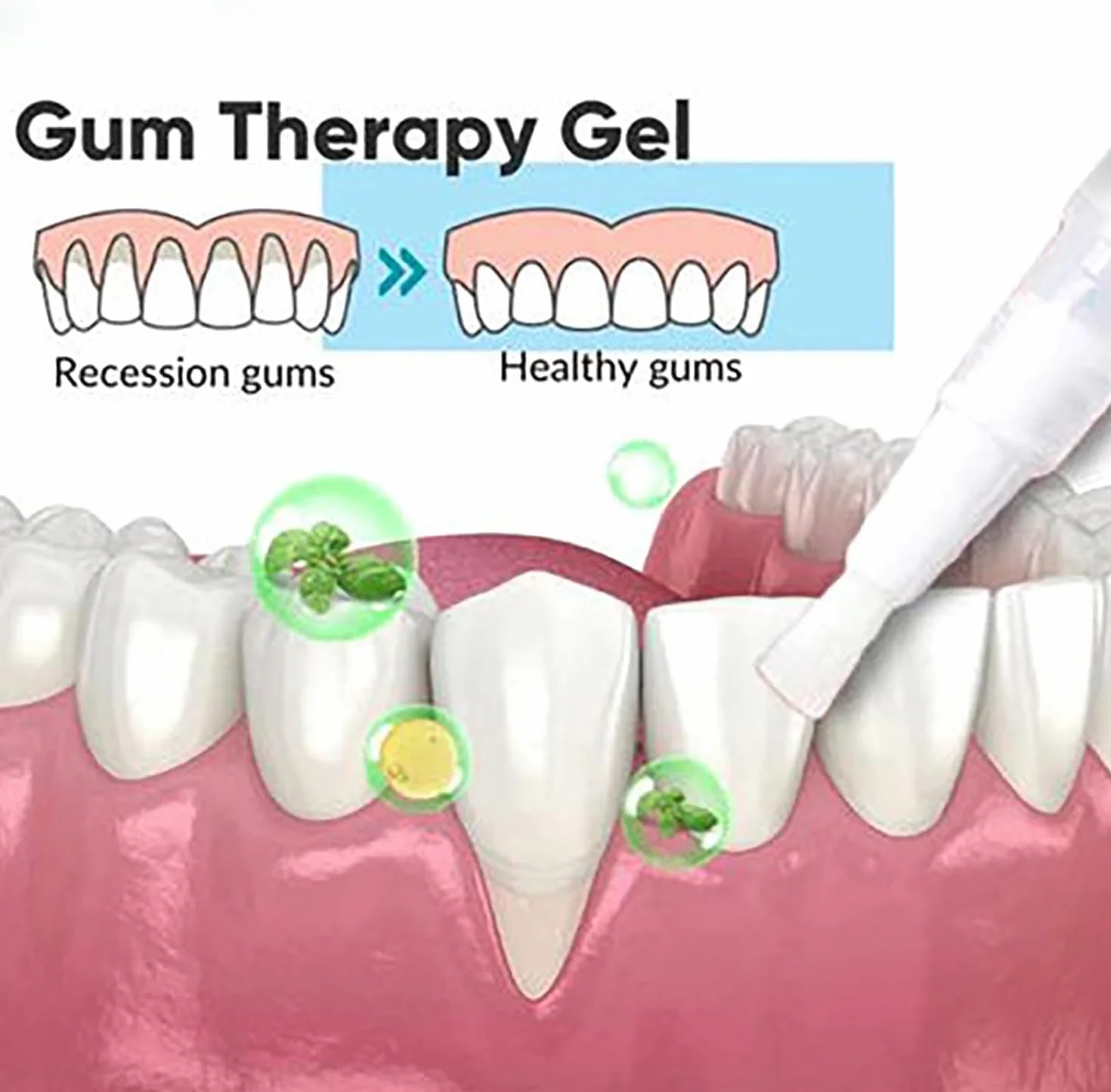 Taileden Gel per Terapia delle Gengive, Aulrz Gum Therapy