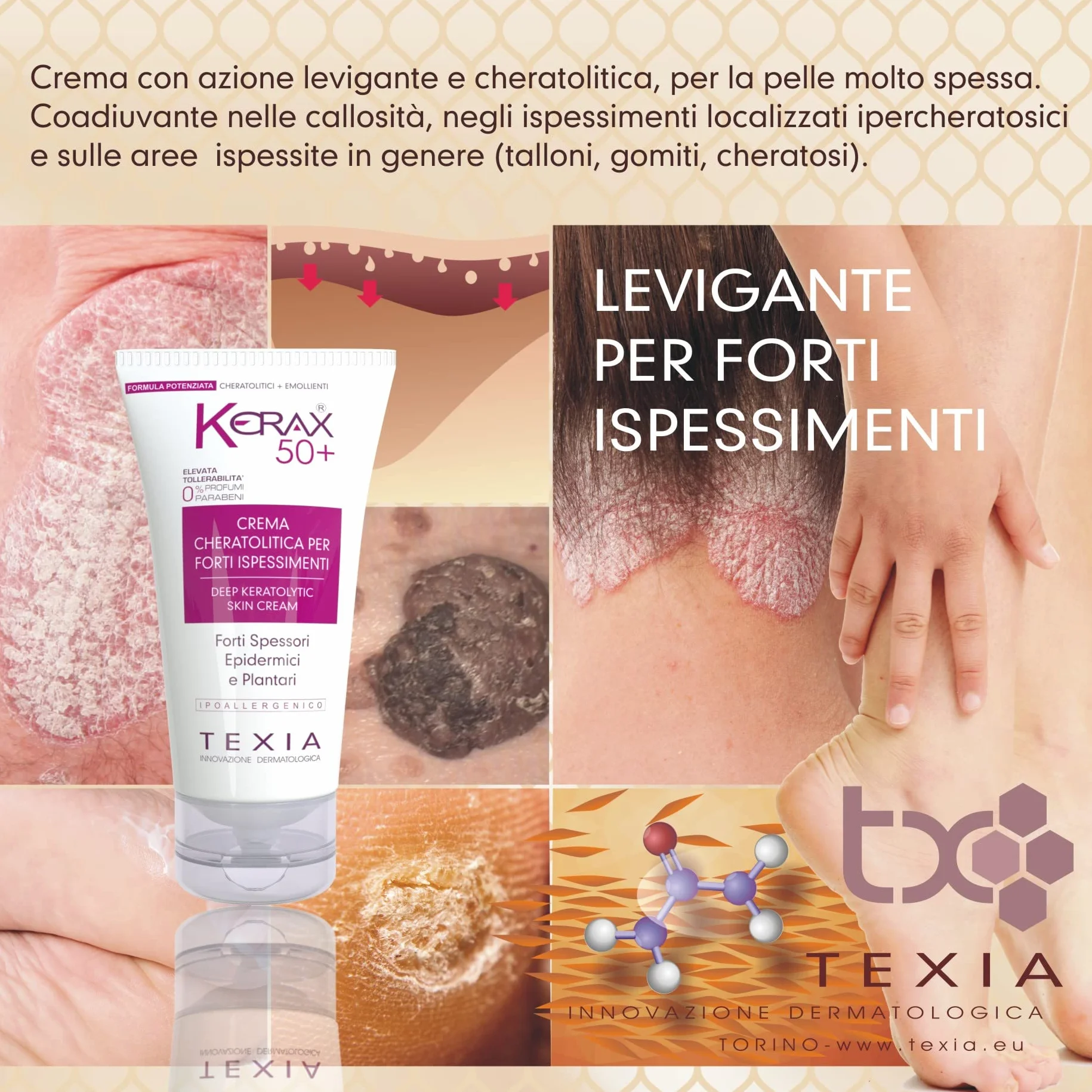 KERAX 50 Lipocrema na silne zgrubienia, keratolityczna, na modzele i odciski
