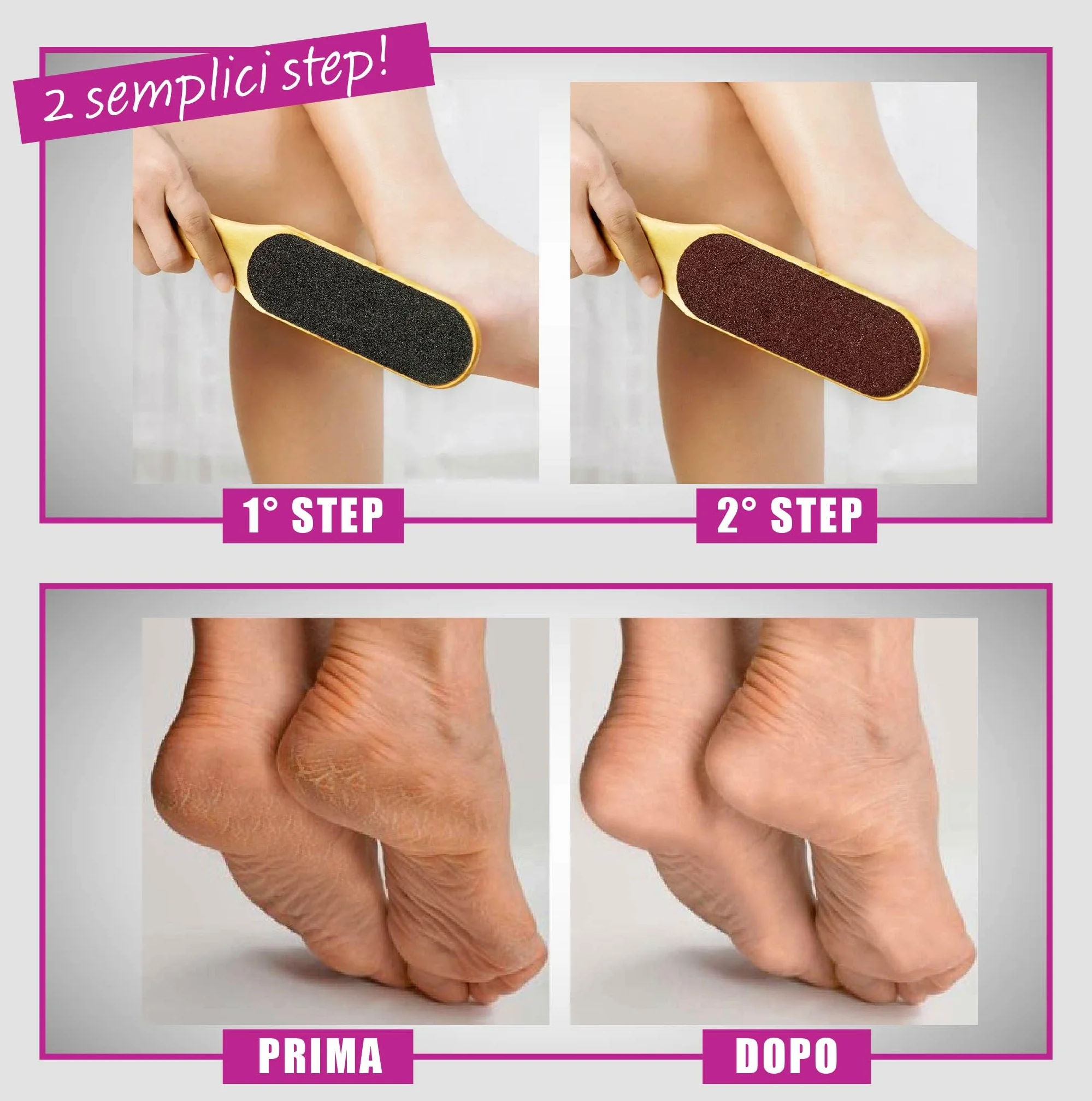 Raspa Piedi Professionale Lima per Piedi e Talloni con Pietra Pomice
