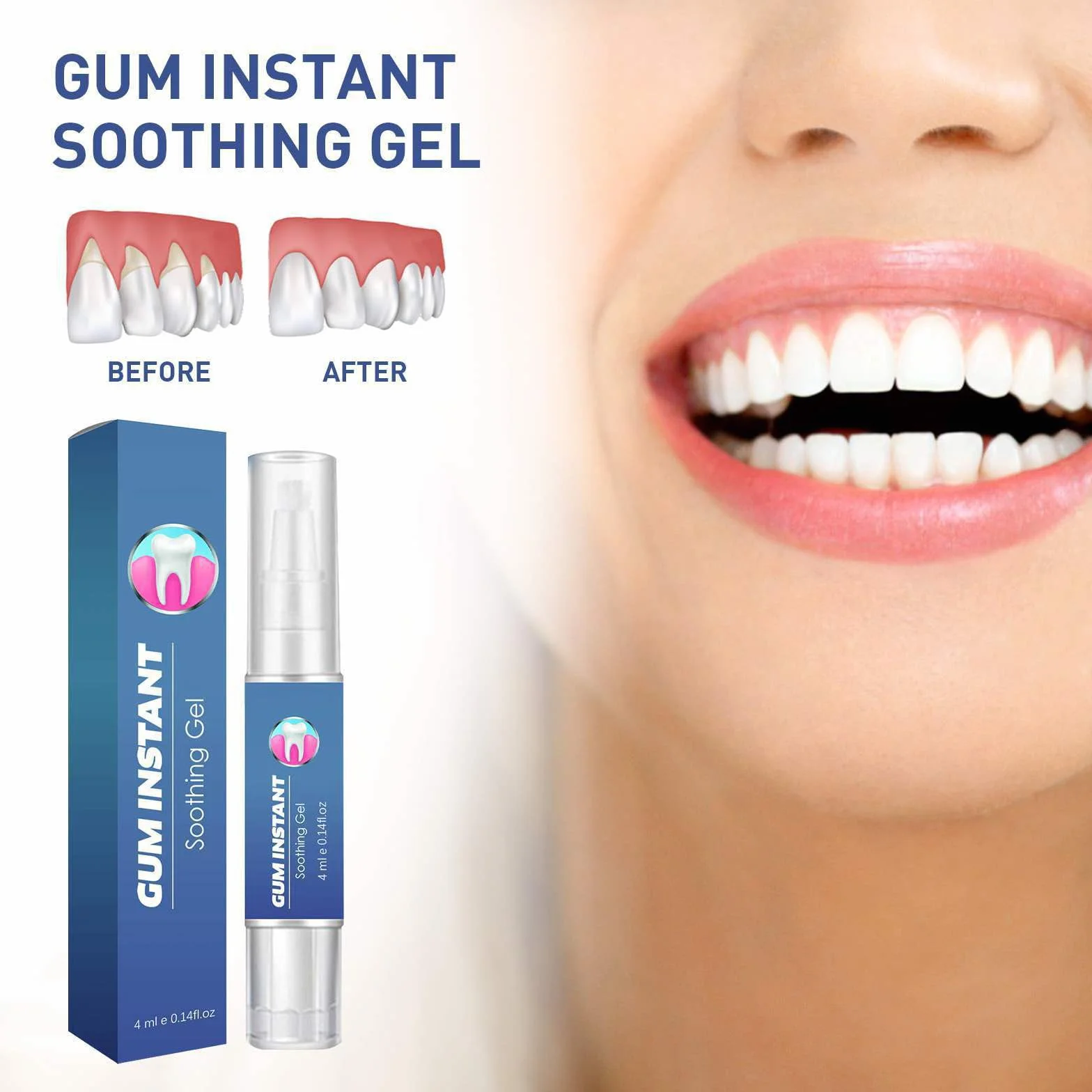 Gel Per Il Trattamento Parodontale Riparatore Protezione Gengive 4ML