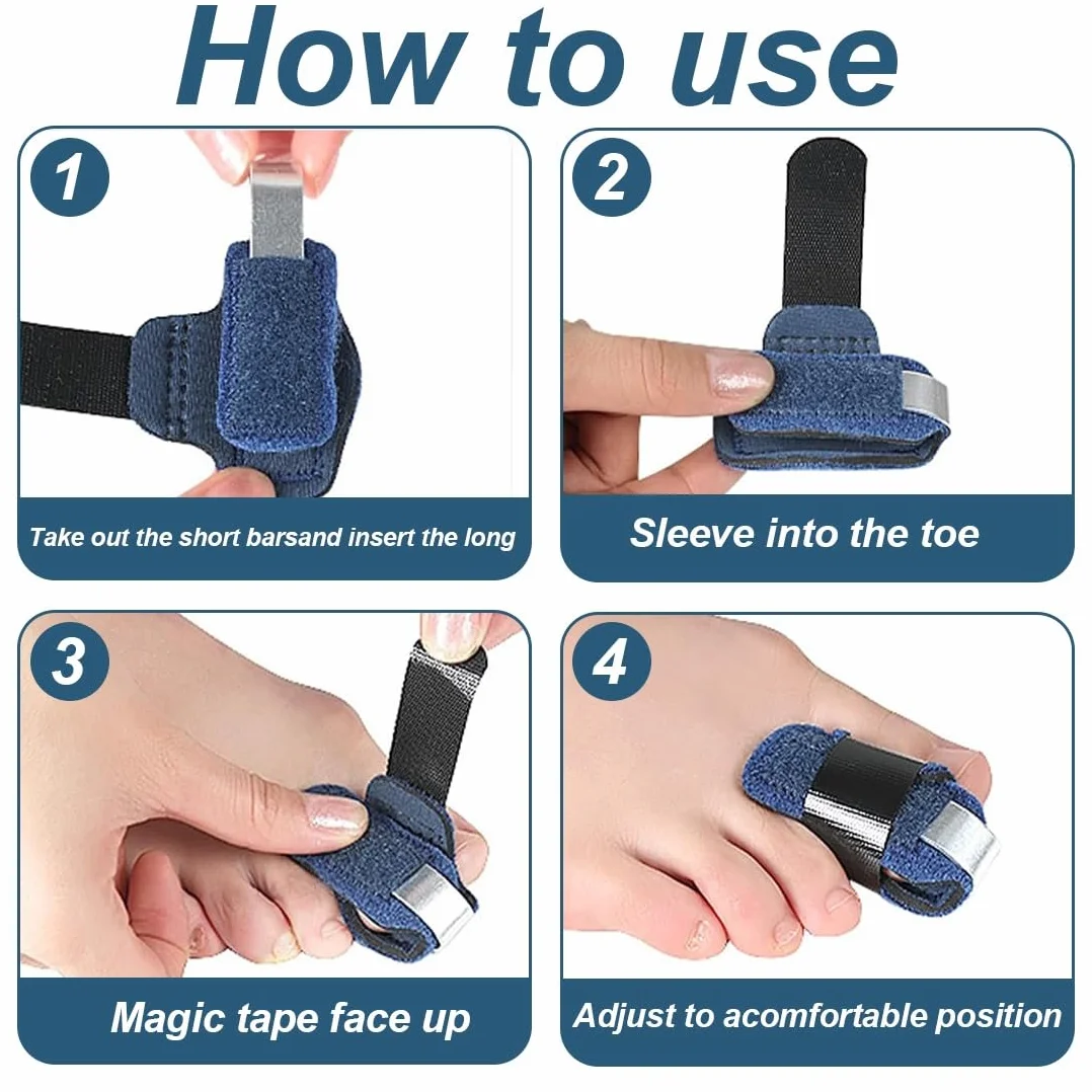 Correttore per dita a martello, stecca per dita piegate, raddrizzatore per dita dei piedi nero, tutore regolabile allineamento dito (blu)