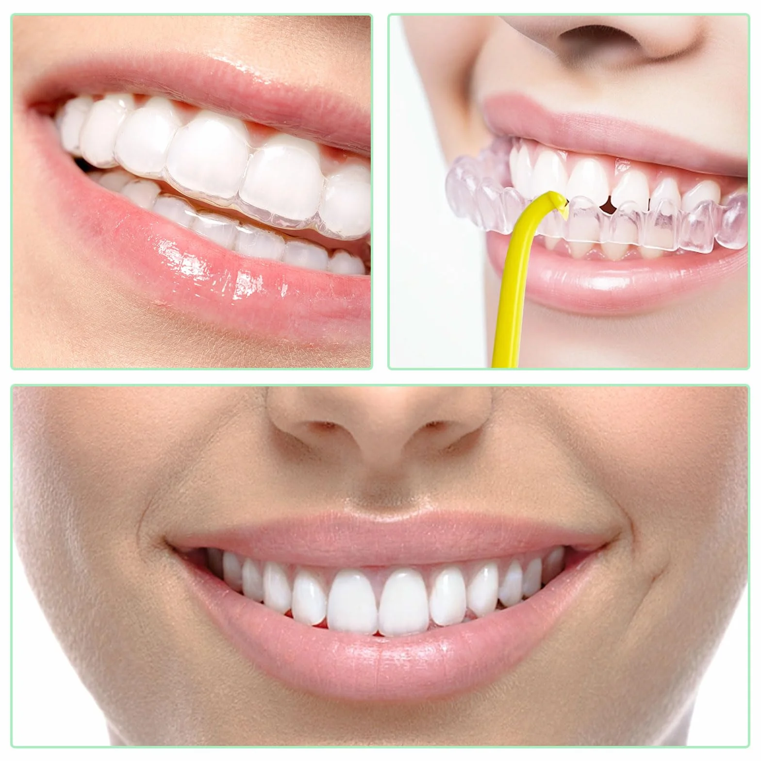 Strumento di Rimozione dell'Allineamento Dentale, Gancio per Apparecchio Invisibile, Aligner Removal Tool per Igiene Orale (30 Pezzi, 5 Colori)
