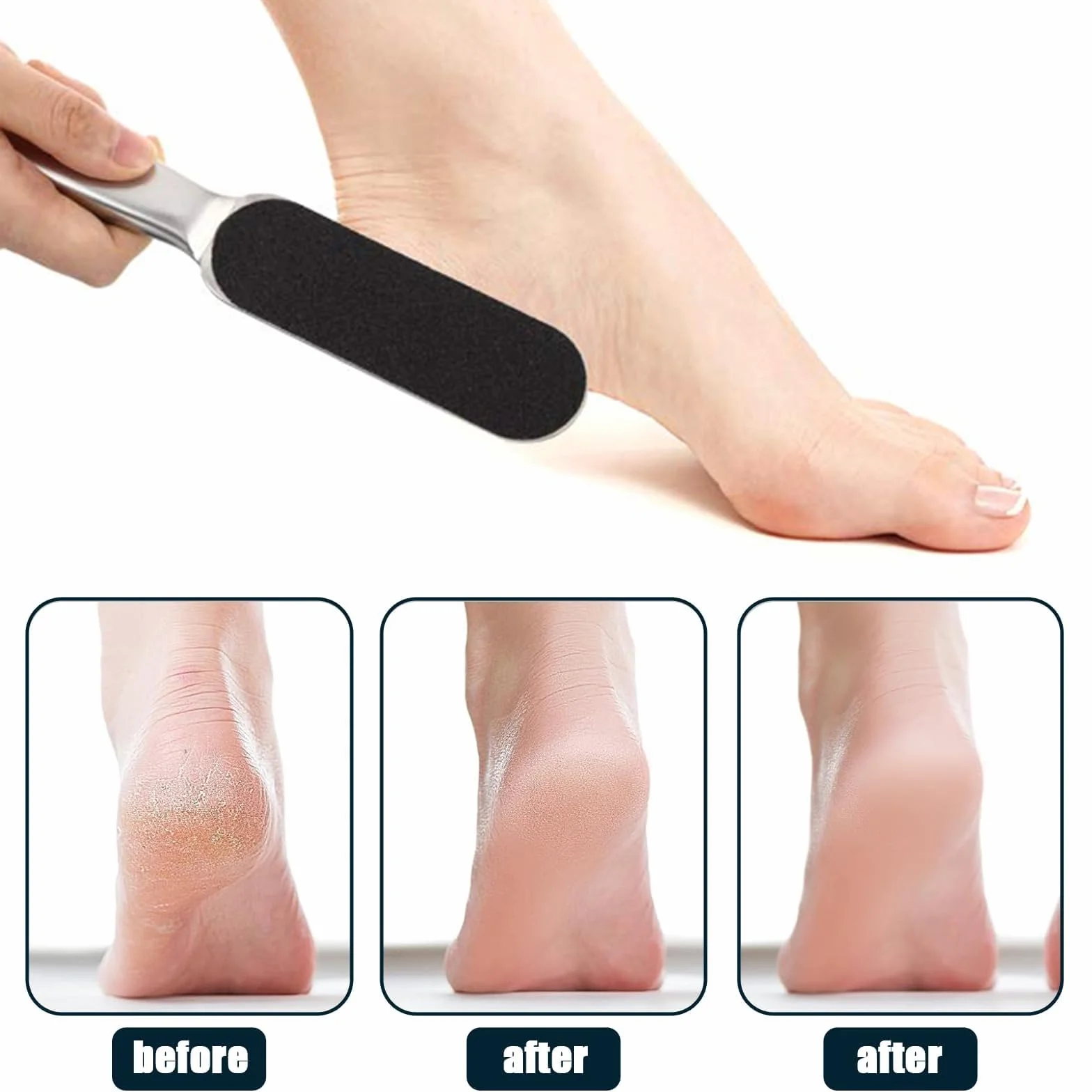 Raspa Piedi Acciaio Inox con 20pcs Carta Abrasiva, Lima per Piedi e Talloni, Calli Remover Pedicure