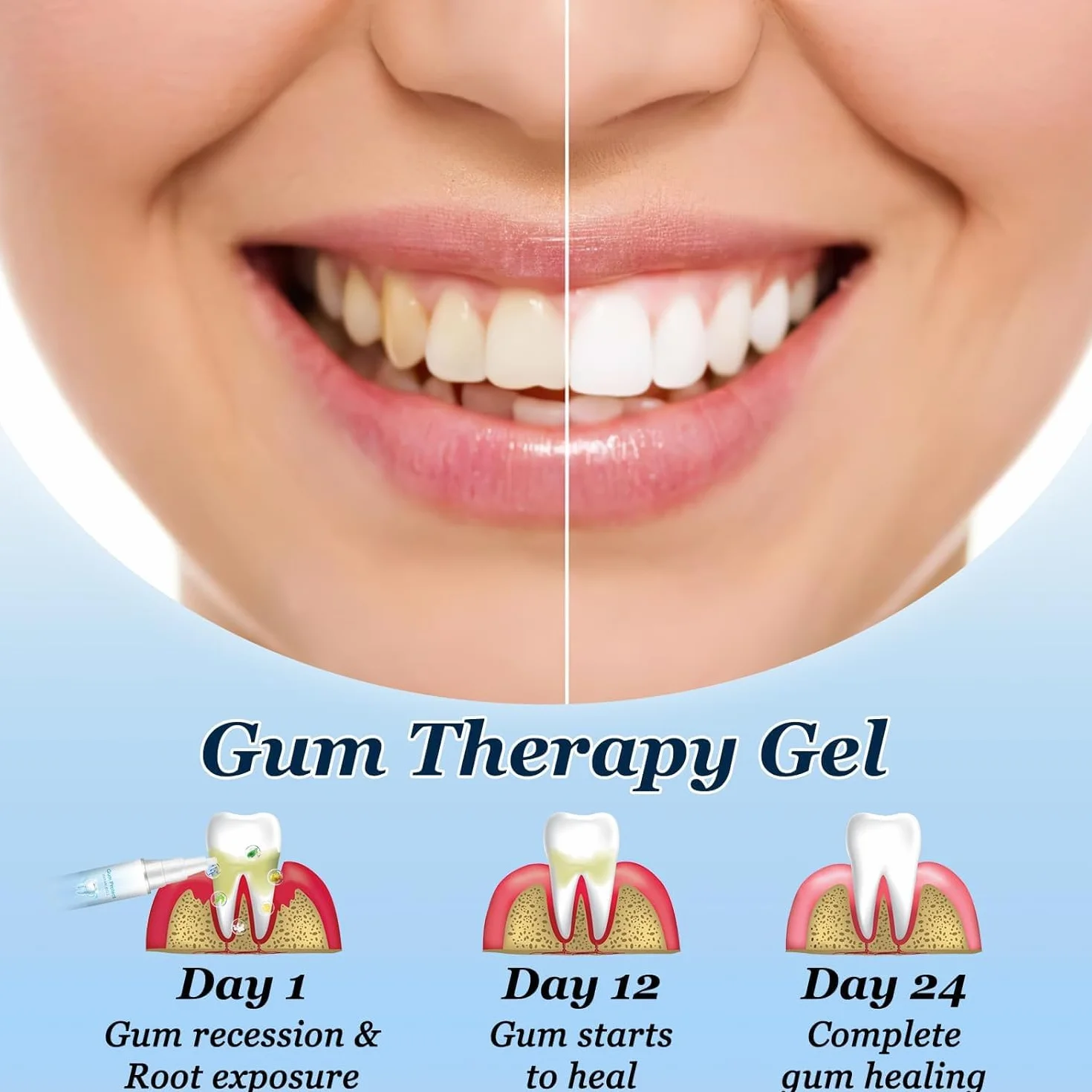 Neslemy Gum Shield Therapy Gel 3-Pack
