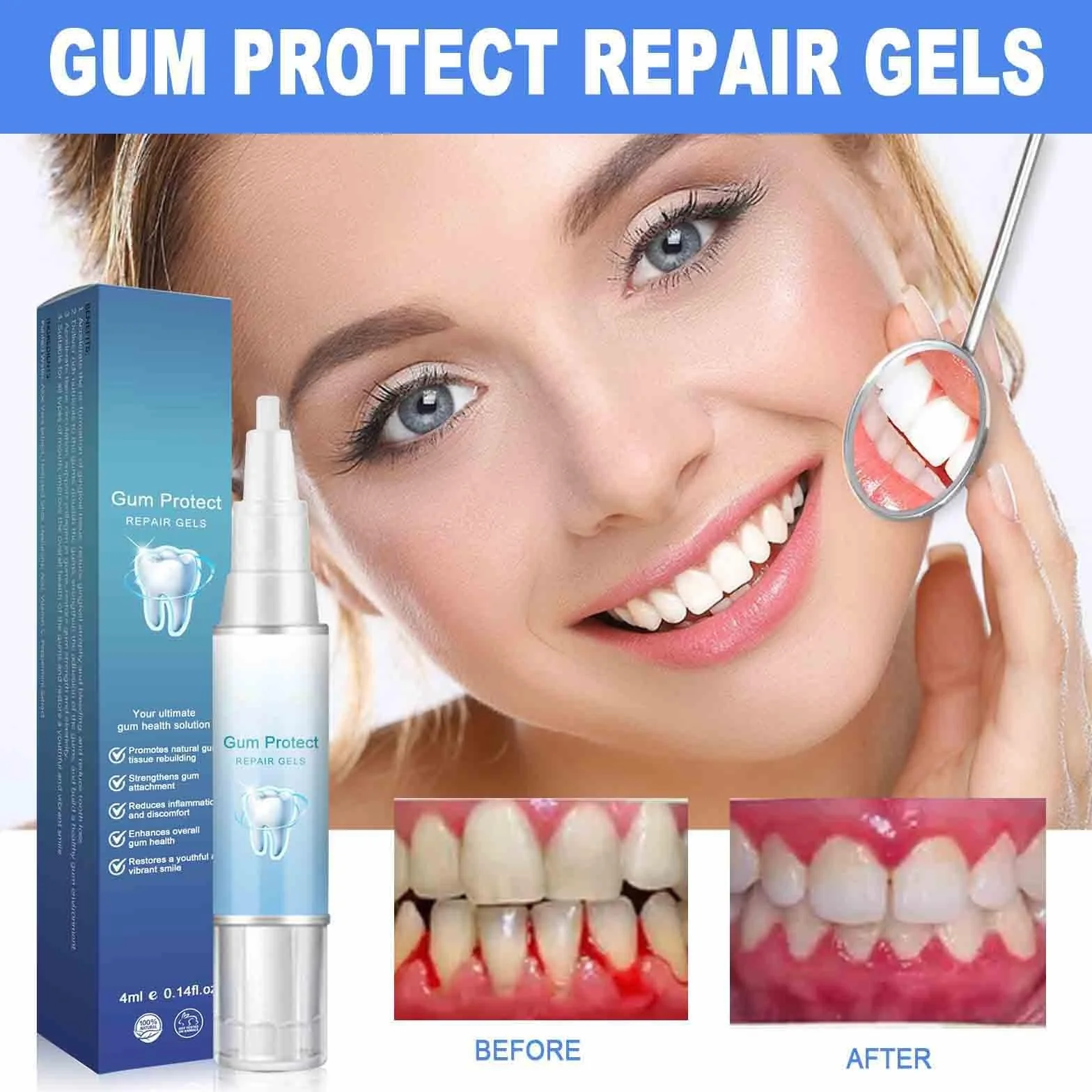 Gel Terapia Gengivale Gum Shield Therapy, Sbiancamento Denti, Riparazione Gengive e Protezione (5)