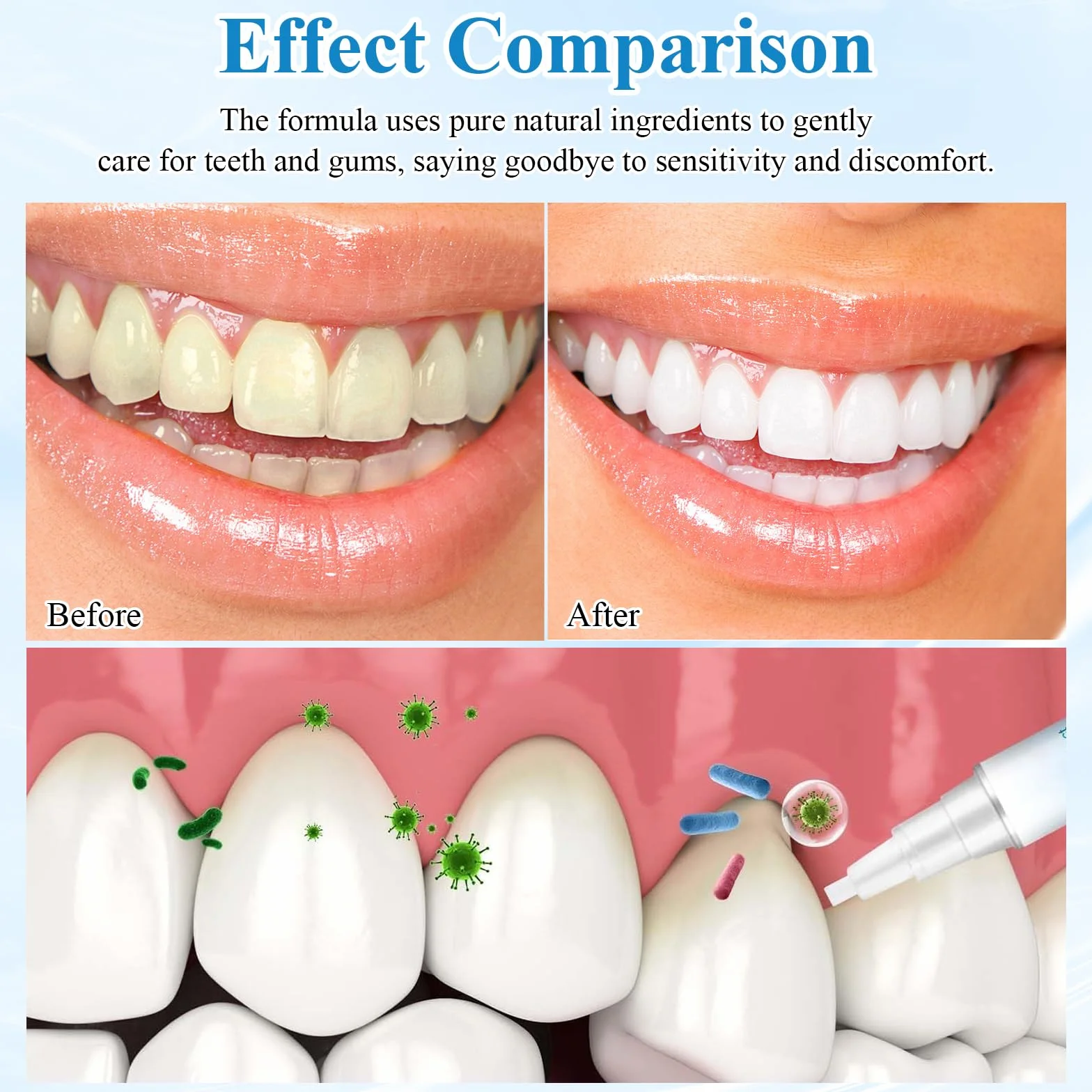 Gel per Terapia Gengivale 3 Pezzi con Scudo Gengivale - Pulizia Profonda Delle Macchie Dei Denti e Del Tartaro