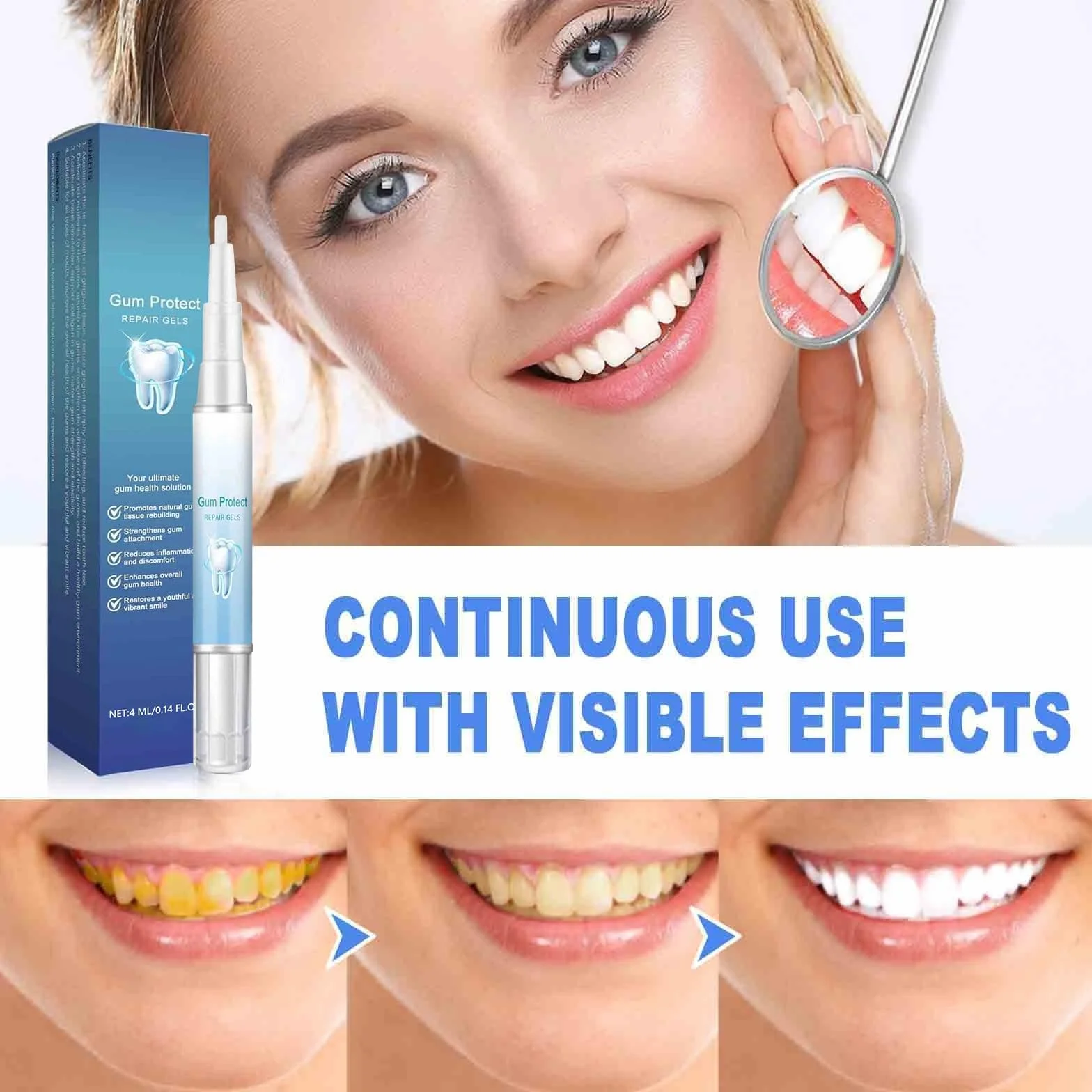 Gum Protect Repair Gel per Terapia Gengivale – Teeth Repair Gel per Riparazione Gengive (5)