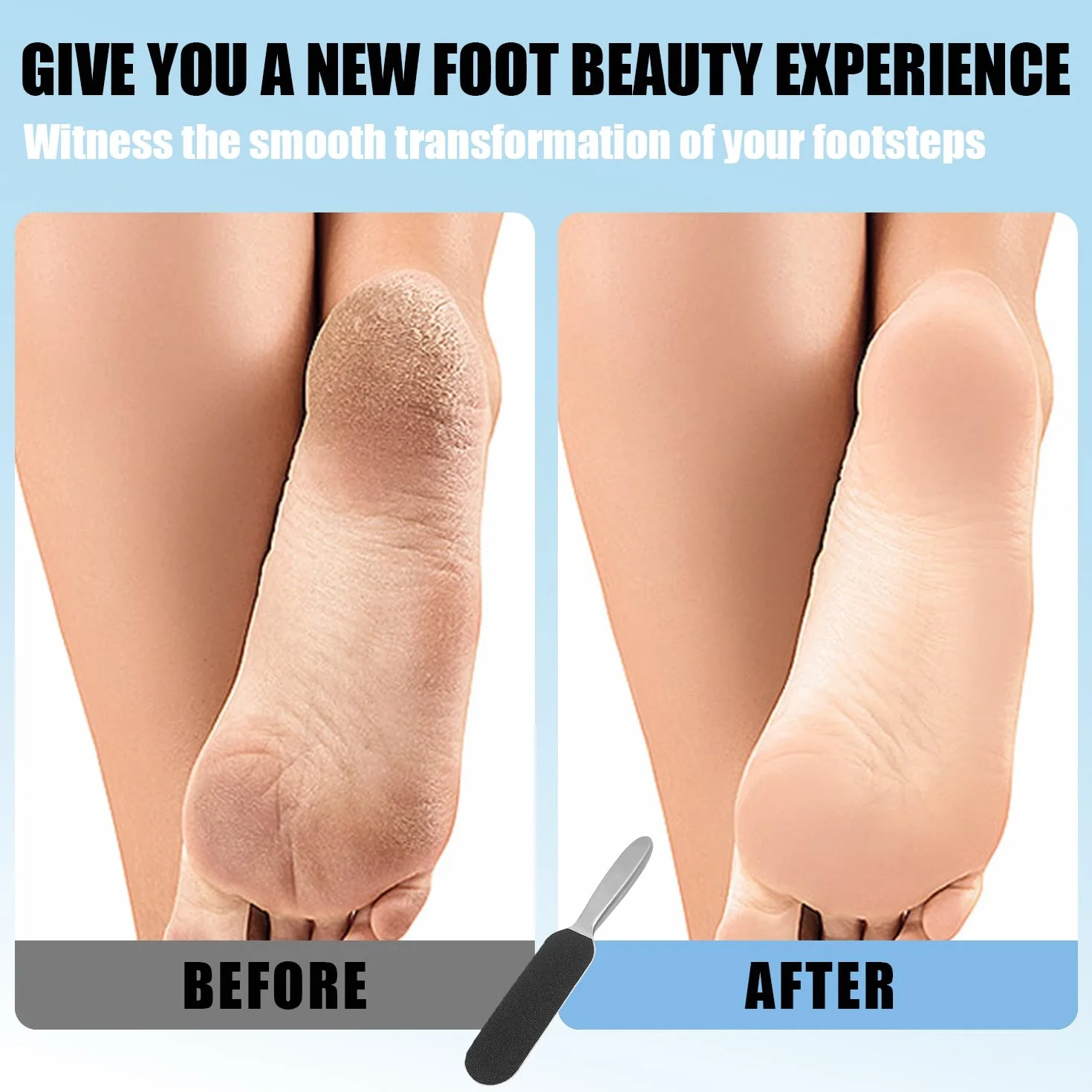 Manico in Acciaio Inossidabile Rimozione Calli Strumenti di Pedicure Professionale