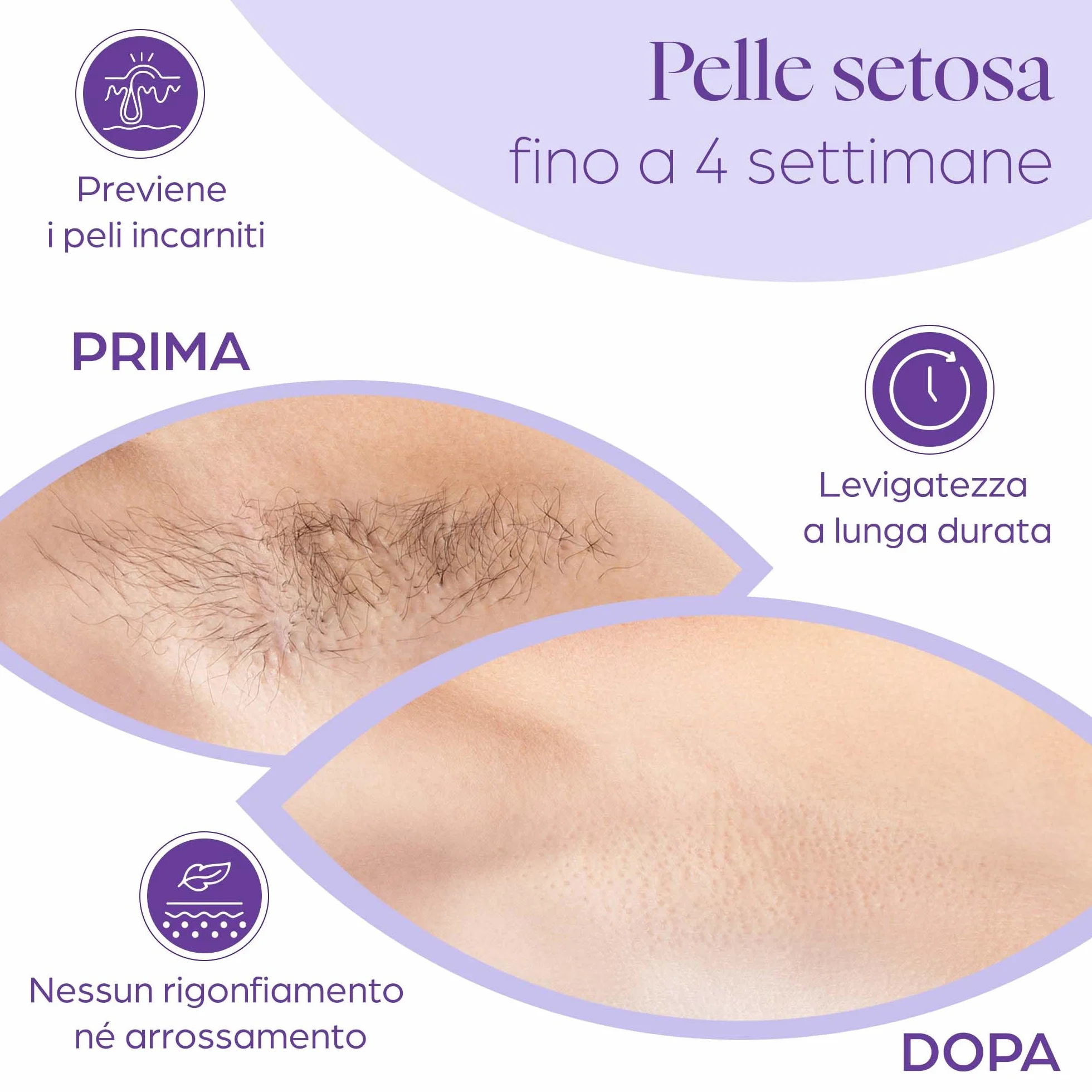 Strisce di cera in tessuto non tessuto 150 pezzi per ceretta viso corpo gambe