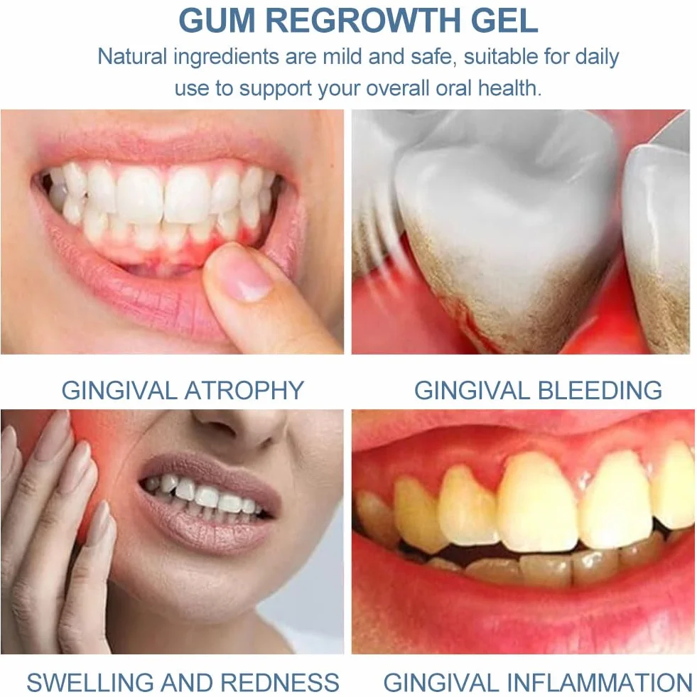 Gengivo Terapia Gel Trattamento Cura Gengive Ricrescita
