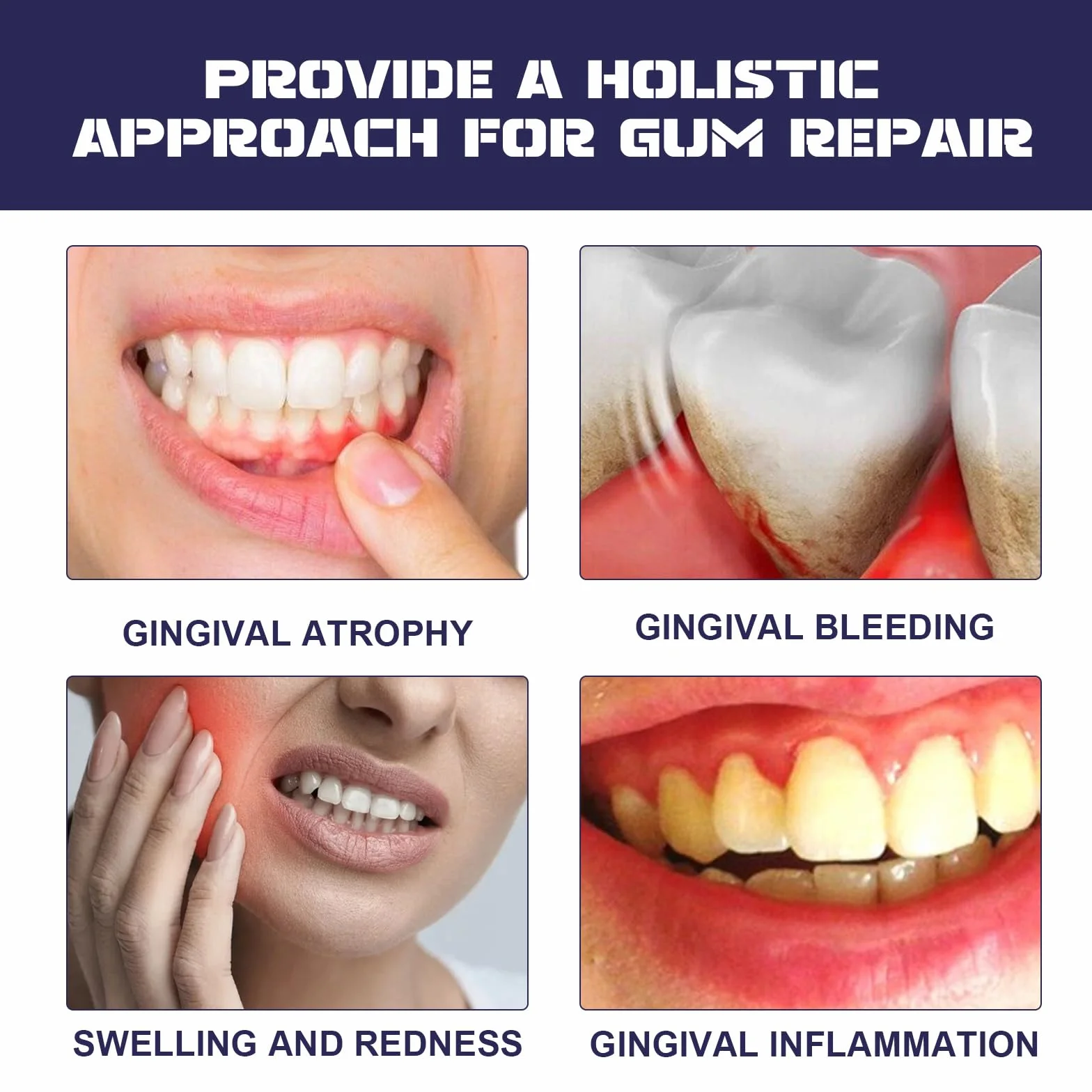 Gel Trattamento delle Gengive, Sbiancante Dentale, Recessione Gengivale