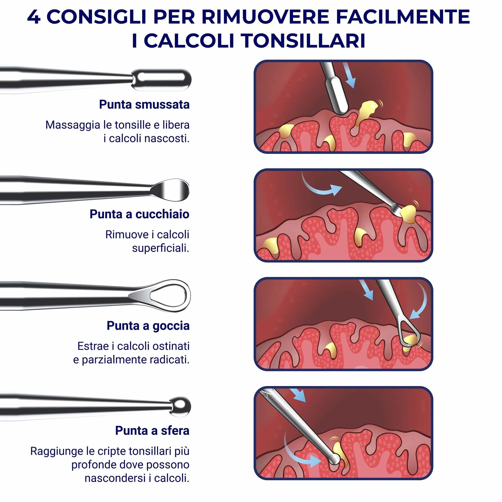 ORAVIX Escavatore Rimozione Calcoli Tonsillari Set 2 Unità 18 cm Strumento Metallo con 10 Punte Silicone