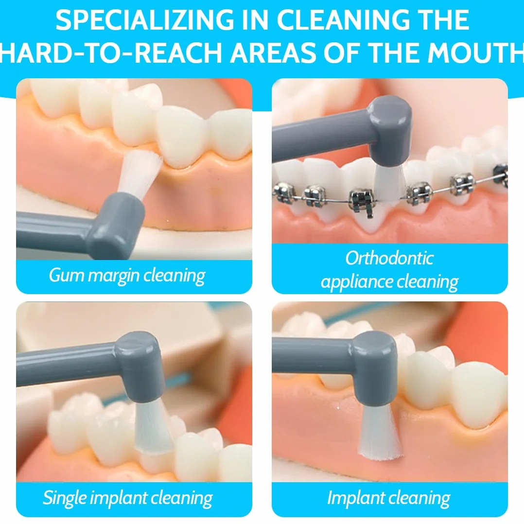 Smacchiatore Denti Professionale 4 Pezzi + Speculum Orale Rimuovi Tartaro per Macchie Caffè Tè Tabacco