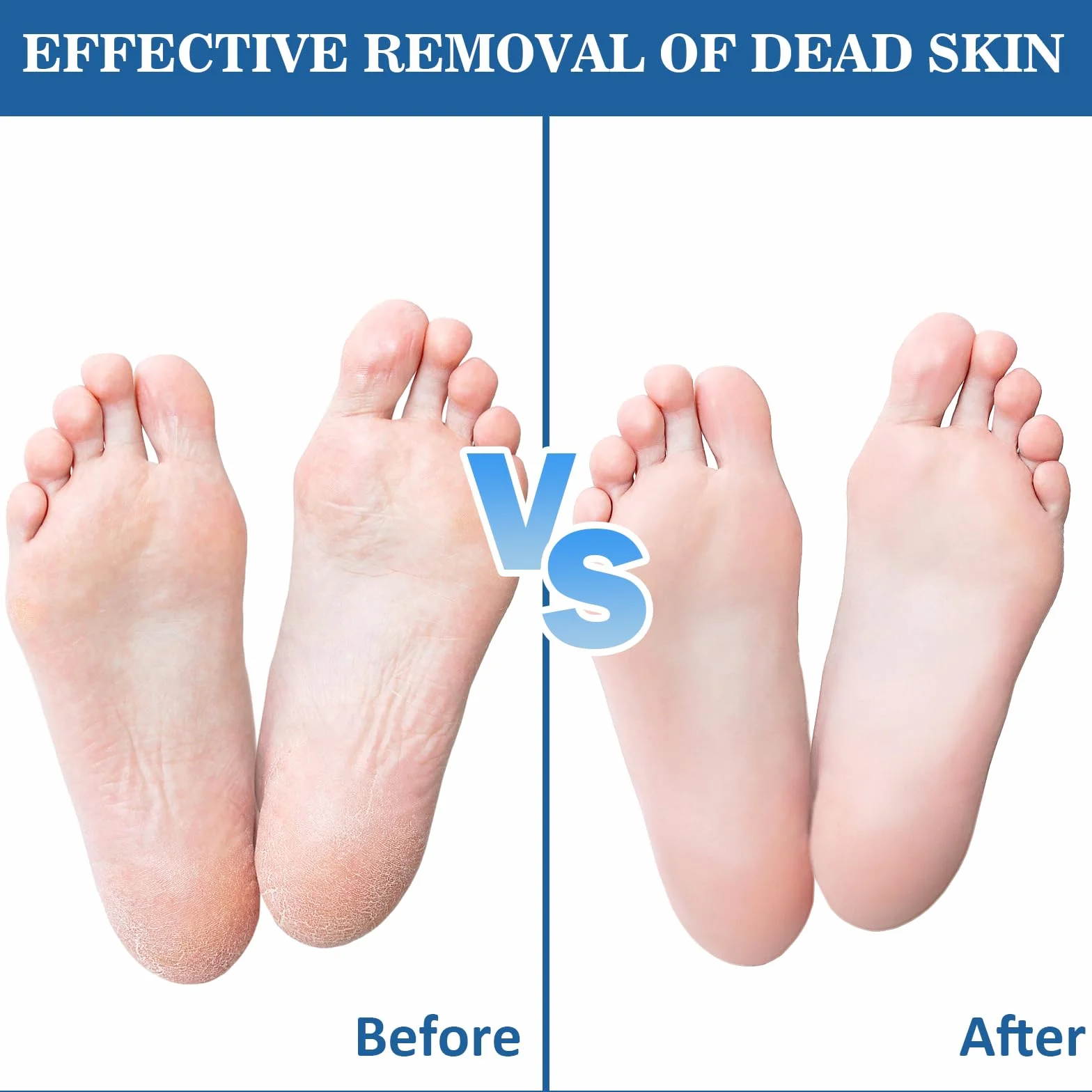 VEGCOO 55 Pezzi Ricambi per Lime Pedicure, Cuscinetti Abrasivi, Carta Vetrata Ricarica, Rimuovere Pelle Morta