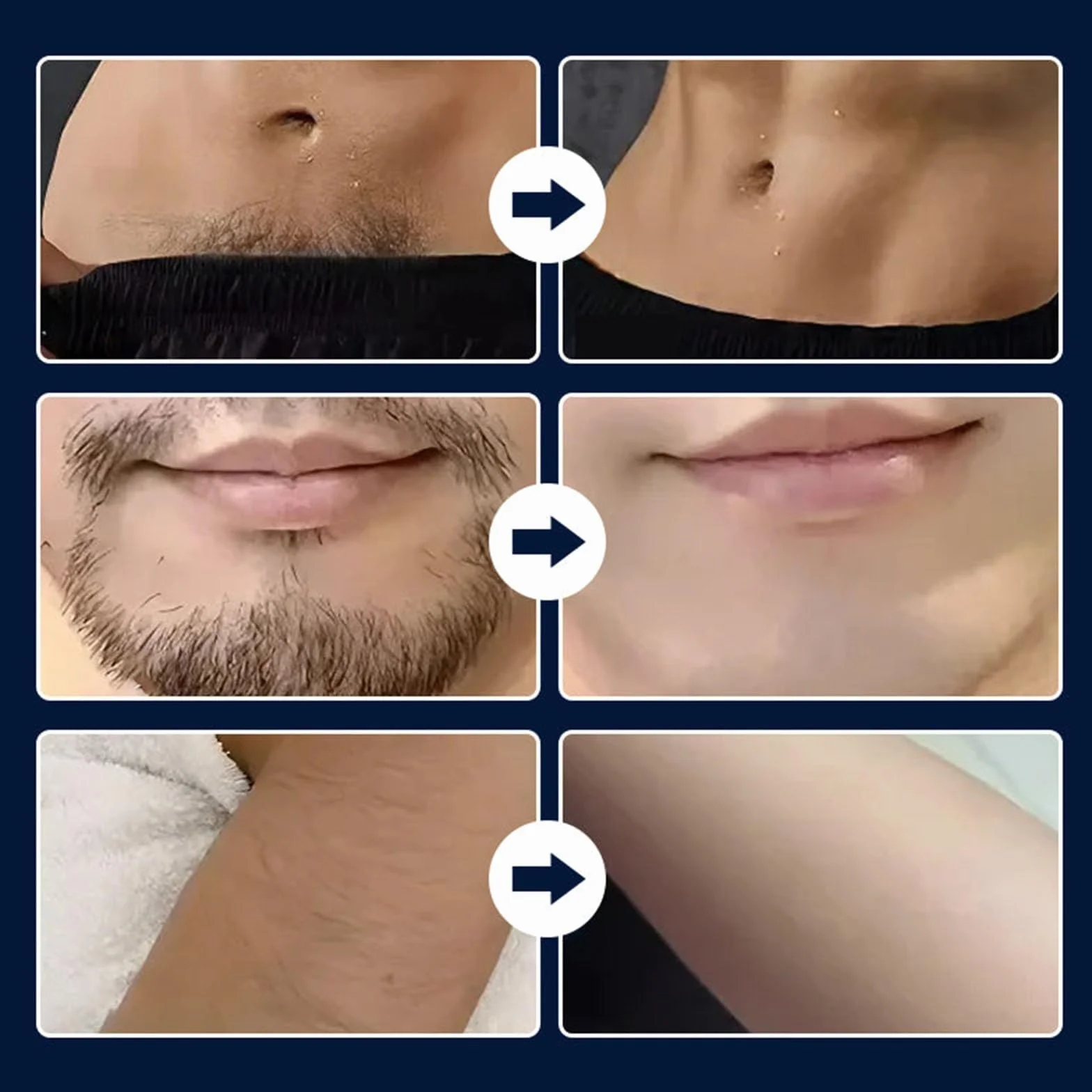 Rasoio elettrico impermeabile IPX7 per peli intimi del corpo uomo