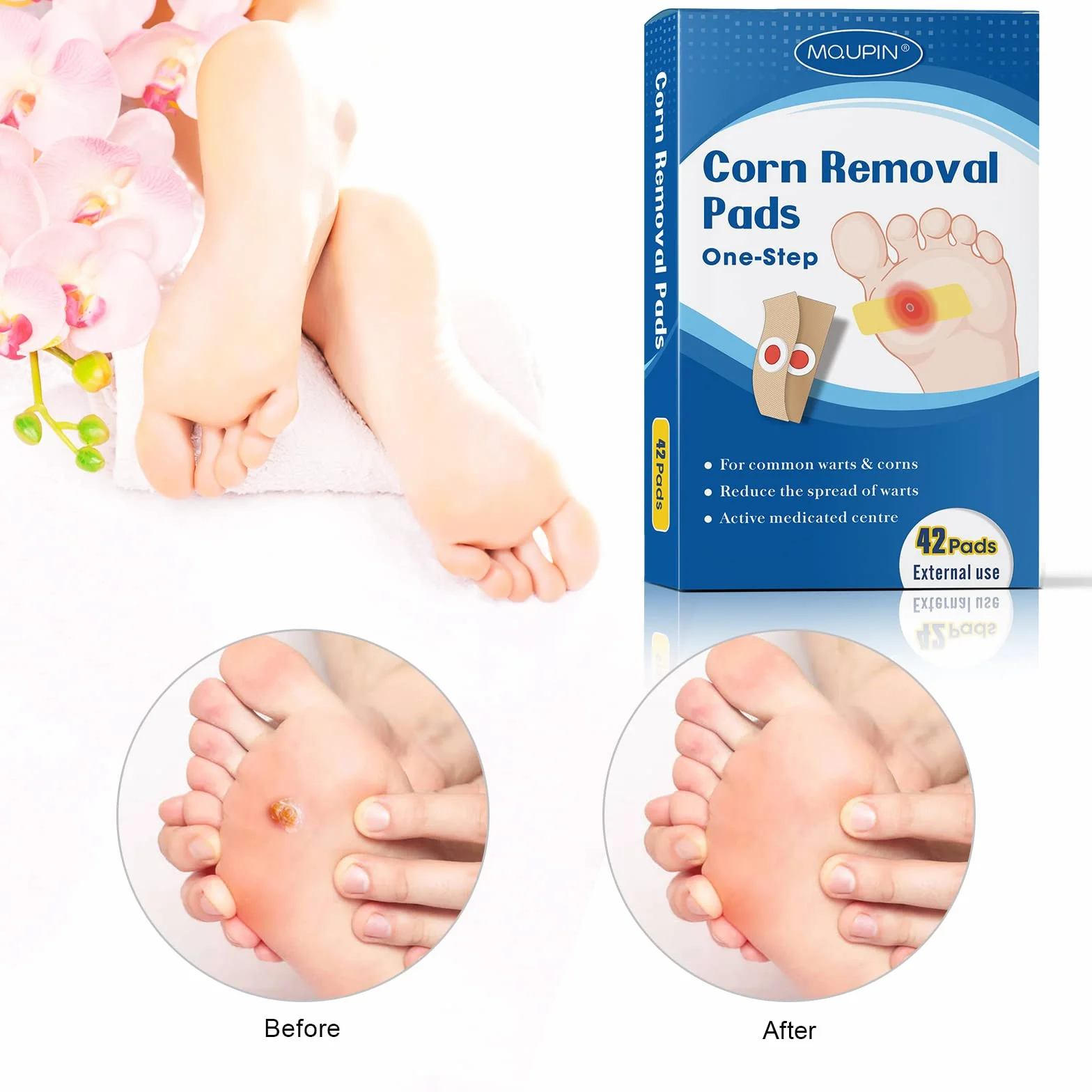 MQUPIN Wart Remover Trattamento Rimozione Verruche Plantari Calli Mais 42pcs