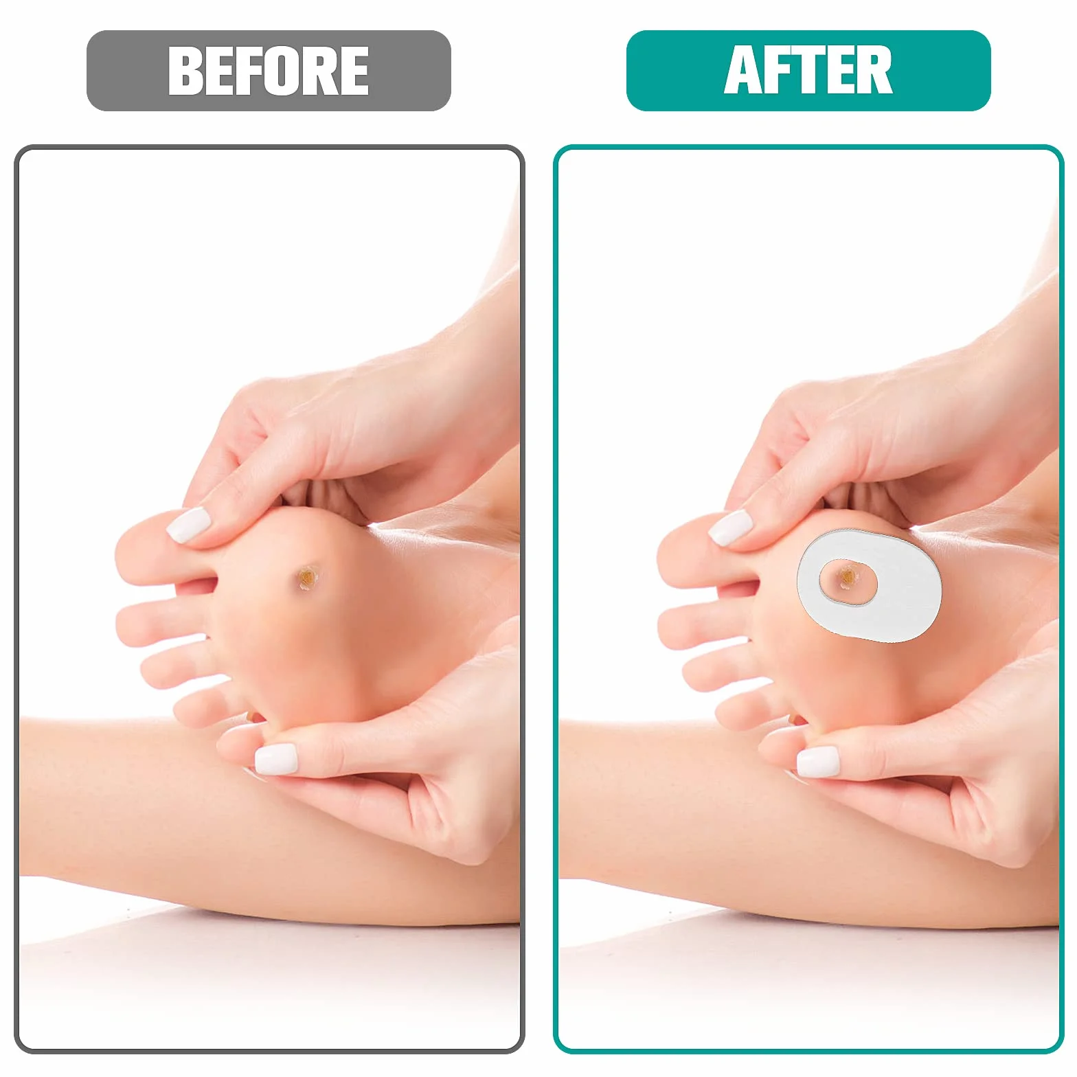 Cuscino per la protezione del piede Autoadesivo 48 pezzi Callus Protection Pads Heel Pads