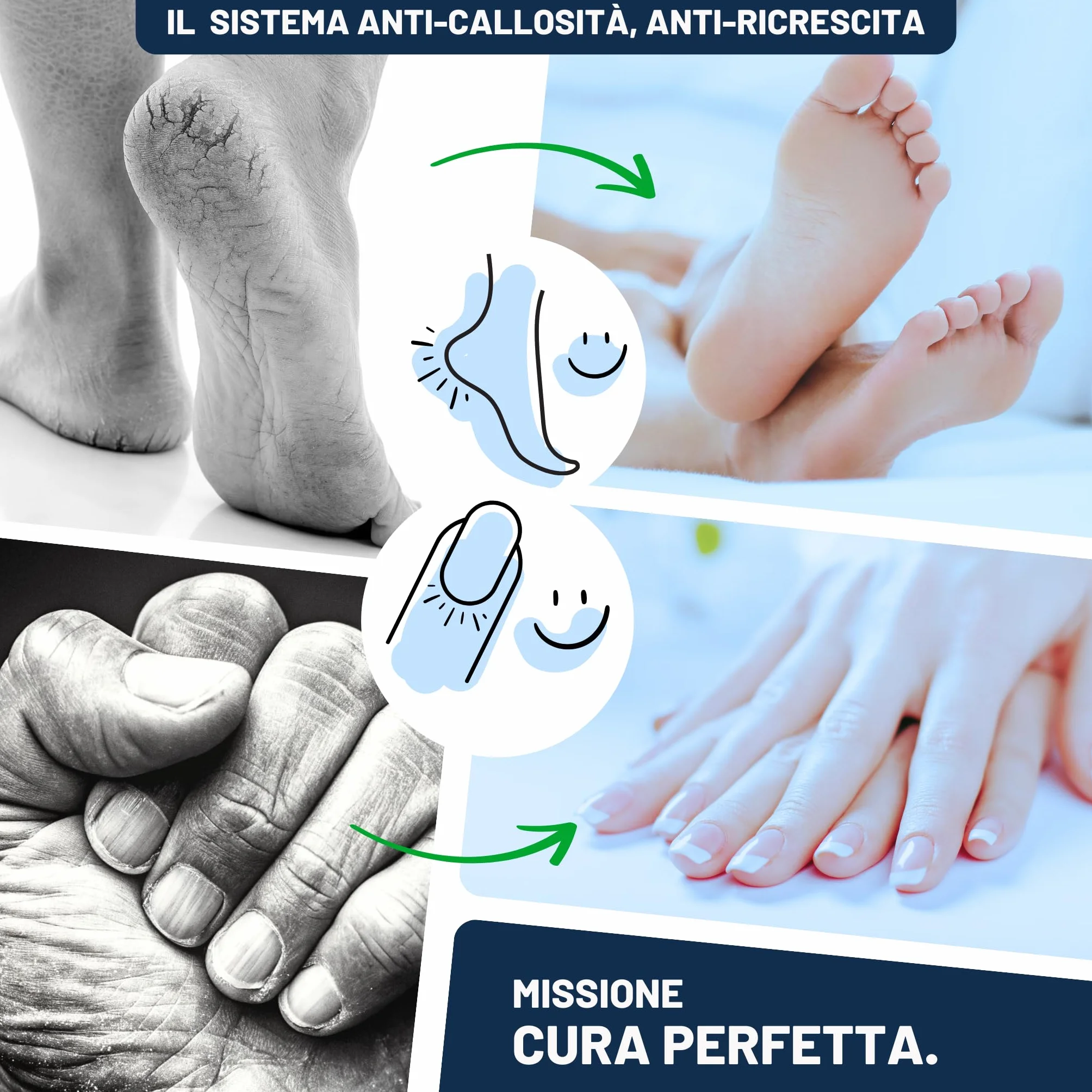 Mr. Fuss Soluzione Attiva Callifuga No. 4 Advanced Pack | Rimozione calli piedi rapida callifugo cheratolitico liquido