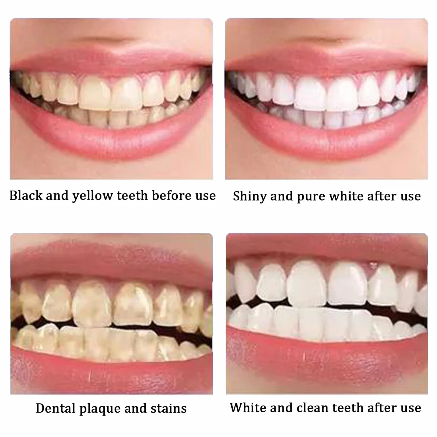 Smacchiatore Denti Professionale 3 Pezzi Rimozione Tartaro Sbiancante Denti per Apparecchi Ortodontici