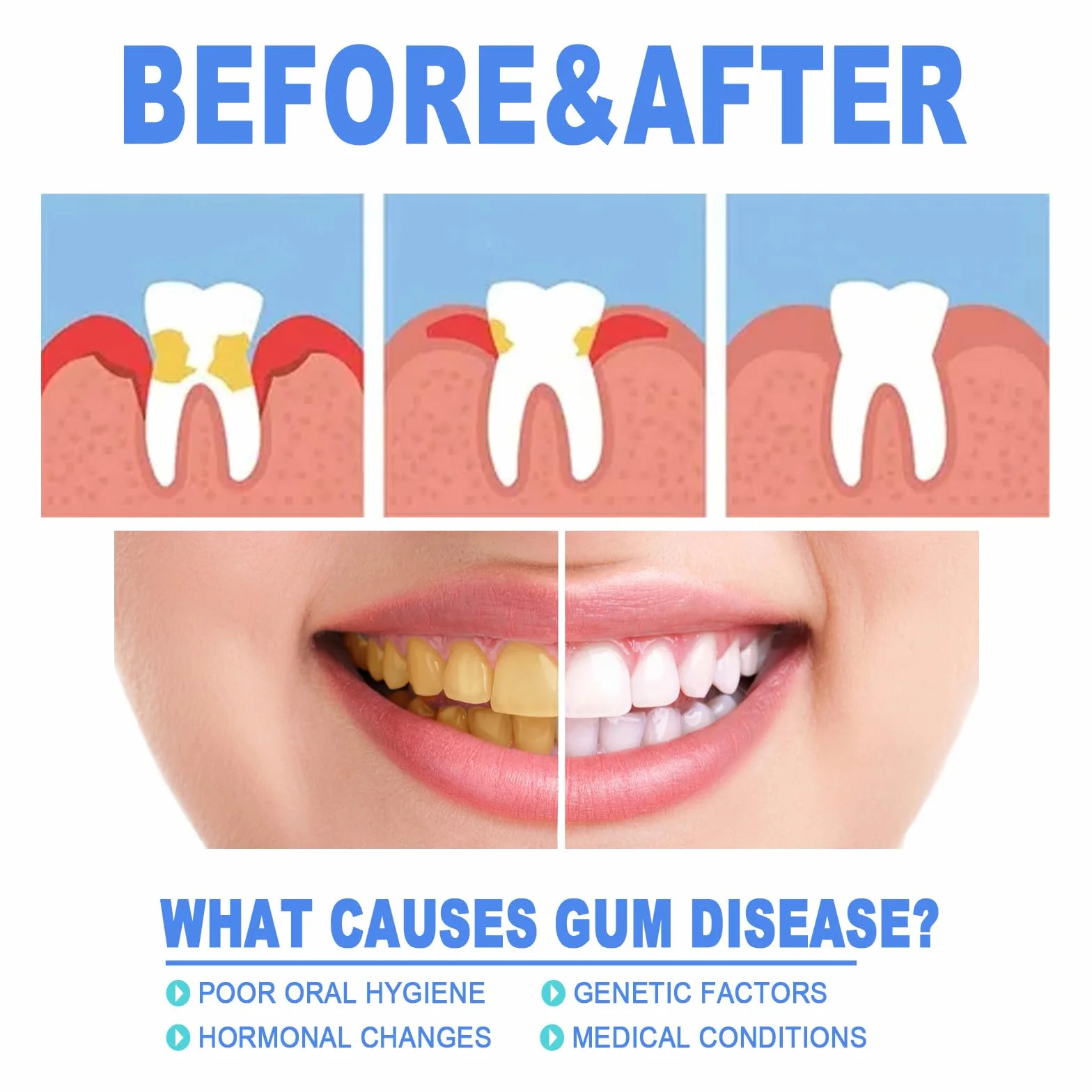 Gum Shield Therapy Gel protezione gengive - Gel terapeutico per gengive, Repain Protect e Gocce Repeller